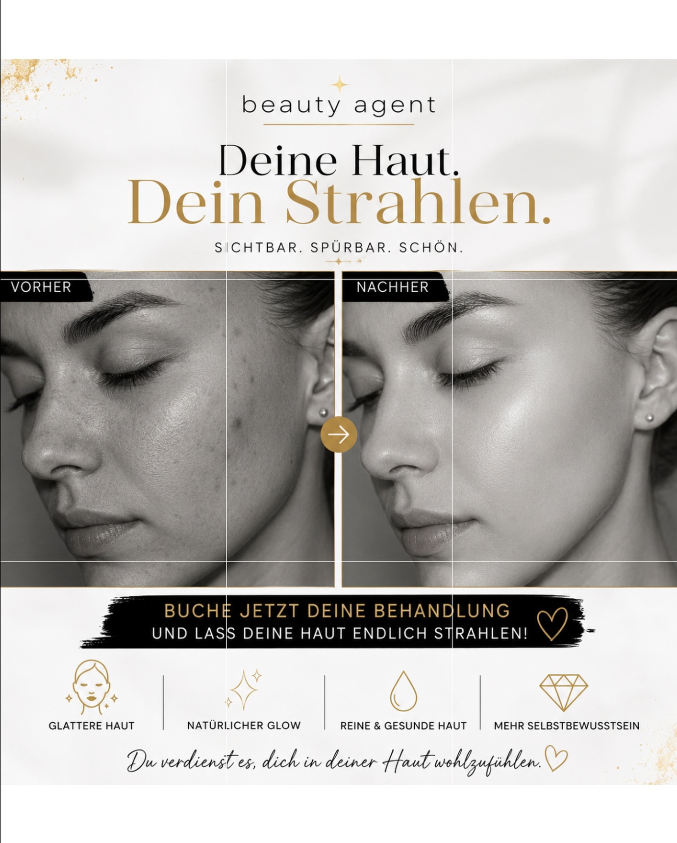 ✨ Strahlende Haut ist deine Visitenkarte. ✨
Deine Haut ist das Erste, was Menschen wahrnehmen. Warum also nicht jeden Tag mit einem frischen, gesunden Glow auftreten❓
Ob Aqua Facial oder OxyGeneo, wir bringen deine Haut auf das nächste Level und unterstützen sie dabei, wieder das auszustrahlen, was bereits in ihr steckt: Frische, Reinheit und natürliche Schönheit. 💎
✔ Tiefenreinigung der Haut
✔ Verfeinerung des Hautbildes
✔ Mehr Feuchtigkeit und Ausstrahlung
✔ Frischer, ebenmäßiger Teint
✔ Sichtbar gepflegtere Haut nach der Behandlung
Viele Kundinnen investieren in Make-up, Filter und teure Pflegeprodukte, obwohl die Basis eine gesunde, strahlende Haut ist. Wenn deine Haut müde wirkt, zu Unreinheiten neigt oder einfach ihren Glow verloren hat, ist jetzt der richtige Zeitpunkt, ihr die Aufmerksamkeit zu schenken, die sie verdient.
✨ Stell dir vor, du verlässt das Studio, schaust in den Spiegel und siehst eine Haut, die frischer, glatter und lebendiger aussieht. Weniger kaschieren. Mehr strahlen. Mehr Selbstbewusstsein.
📅 Sichere dir jetzt deinen Termin und gönne deiner Haut die Pflege, die sie verdient.
📩 Schreibe uns eine Nachricht oder buche direkt deinen Wunschtermin.
beauty agent
✨ Weil schöne Haut kein Zufall ist. ✨
#beautyagent #hautpflege #aquafacial #oxygeneo #glowingskin
hydrafacial hautverbesserung kosmetikstudio hamburg strahlendehaut antiaging skincare beautytreatment hautgesundheit glowup