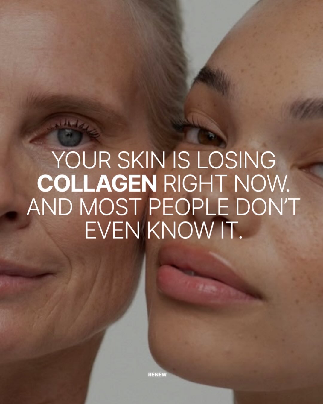 Your skin changes with time. That’s natural.
After 25, collagen production gradually slows, and over the years it can show up as fine lines, reduced elasticity, and a loss of glow.
That’s why we created RENEW Collagen formulated with hydrolysed collagen peptides designed for optimal absorption and daily support from within.
💜 One sachet a day.
💜 Simple routine.
💜 Consistent results.
Because healthy-looking skin isn’t built overnight it’s built every day.