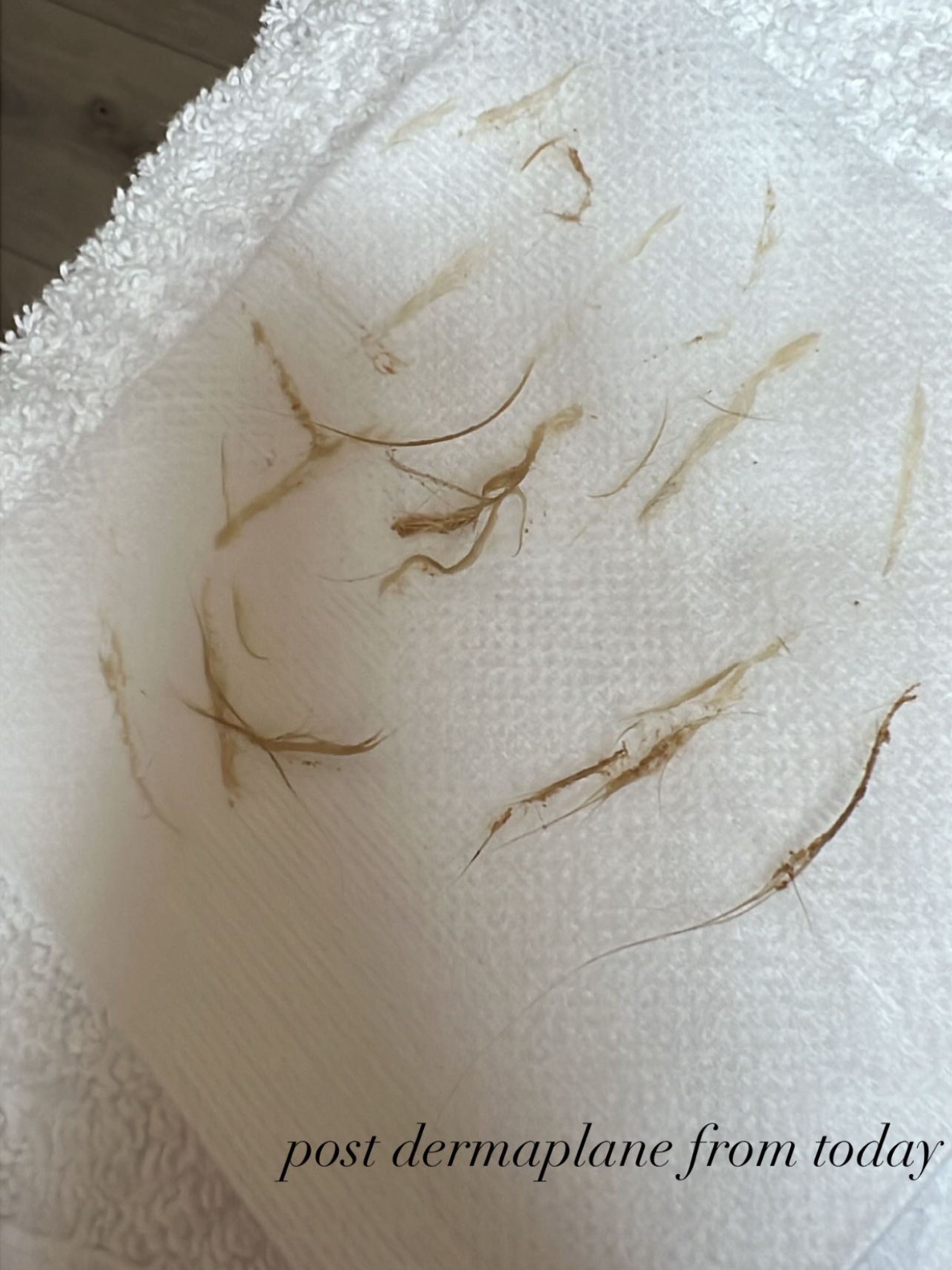 The after of a post dermaplane recently!