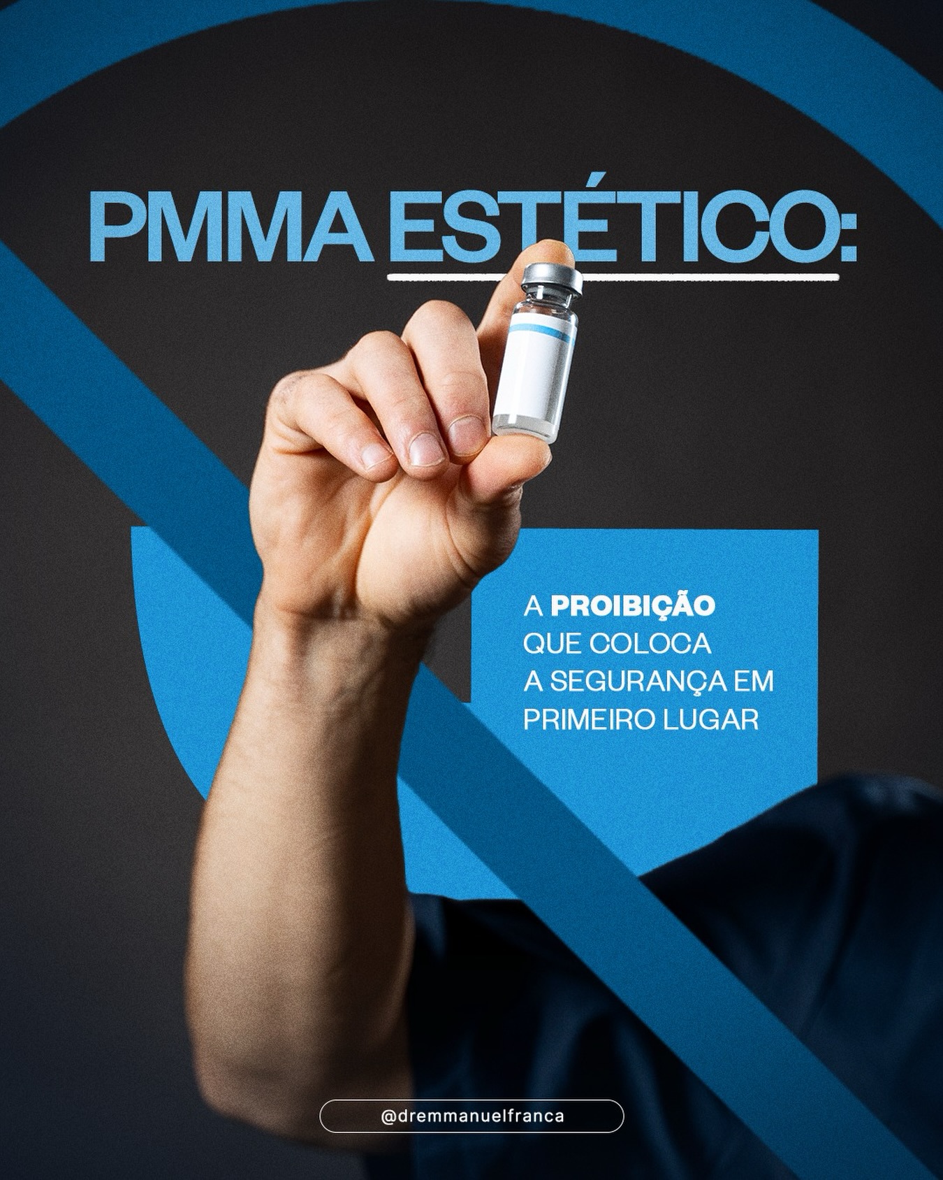 A decisão do Conselho Federal de Medicina de proibir o uso do PMMA para fins estéticos representa um importante avanço na proteção dos pacientes.
O PMMA é um material permanente e, ao longo dos anos, esteve associado a complicações que podem surgir imediatamente ou até muitos anos após a aplicação, incluindo inflamações, infecções, migração do produto, deformidades e outras intercorrências de difícil tratamento.
Na dermatologia moderna, envelhecer bem não significa buscar soluções definitivas ou exageradas. Significa realizar um gerenciamento responsável, individualizado e baseado em tecnologias seguras, bioestimuladores, toxina botulínica, cuidados com a pele e acompanhamento médico contínuo.
A boa medicina evolui quando a segurança vem antes da promessa de resultados.
Essa decisão reforça exatamente esse caminho: mais ciência, mais responsabilidade e mais proteção para quem busca procedimentos estéticos.