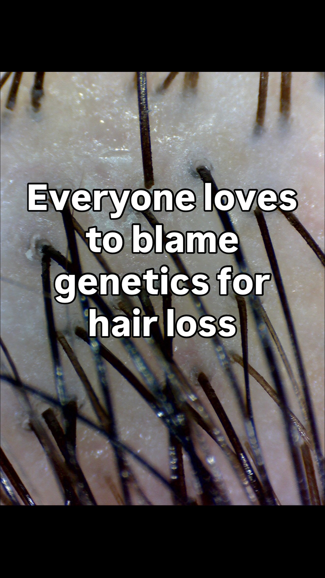 A pretty cool milestone today.
I was recently quoted in an article about men’s hair loss, and seeing my work featured alongside dermatologists, surgeons, and other hair-loss experts was an honor.
The quotes they highlighted are ideas I talk about every day:
✔️ Genetics matter, but they’re often not the whole story.
✔️ Hair loss is frequently one of the first places the body waves a red flag that something has changed.
✔️ Prevention and early intervention are almost always easier than trying to rebuild what’s already been lost.
Most people think hair loss is just about hair. In reality, it’s often a conversation about stress, hormones, inflammation, nutrition, scalp health, and overall wellness.
Grateful for opportunities like this to help more people understand what’s really happening beneath the surface. ❤️