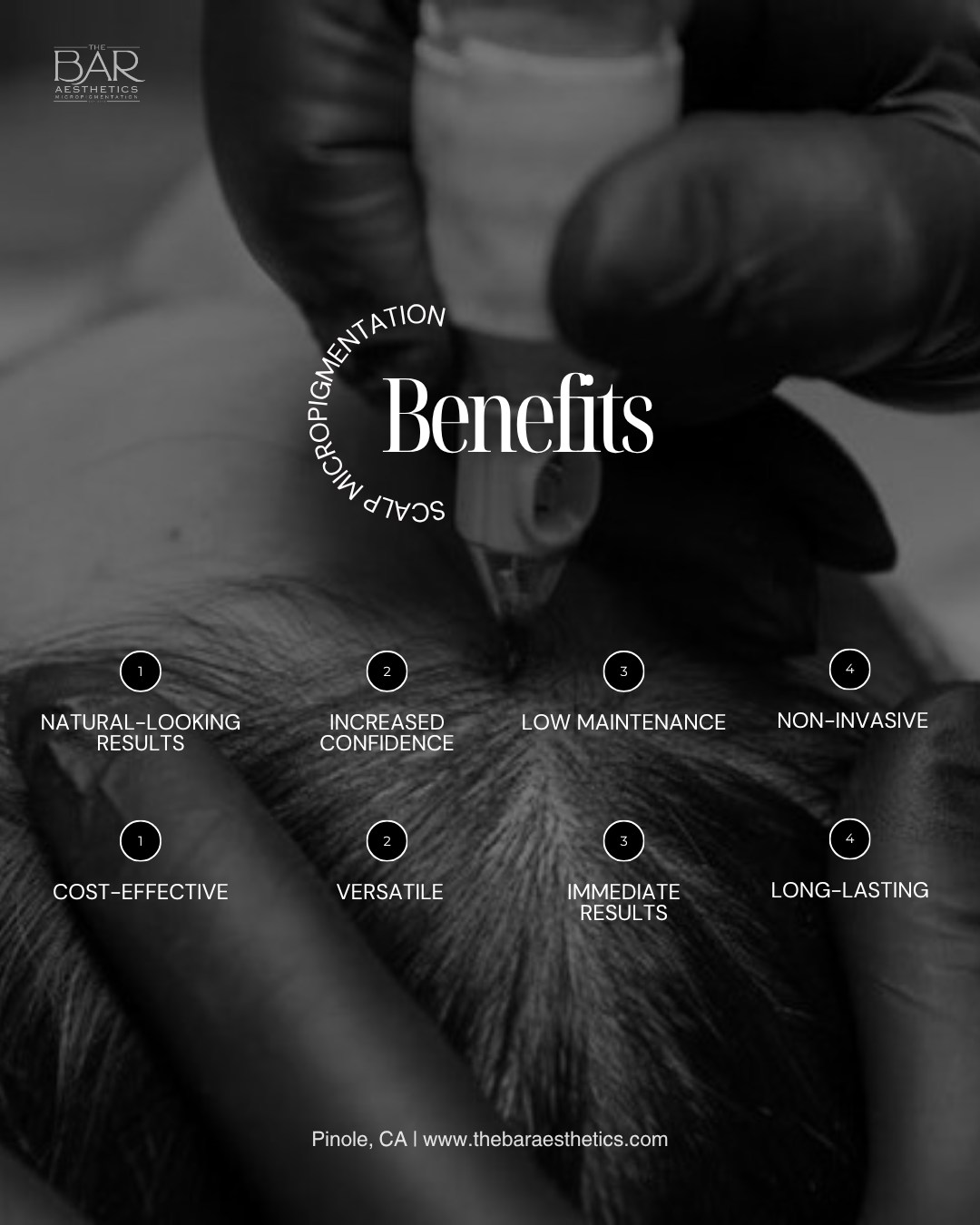 Why is Scalp Micropigmentation (SMP) growing so fast in popularity? Here's why our clients are LOVING it 👇
• Non-invasive
• Natural looking
• Long-lasting
• Low maintenance
• Cost-effective
• Customizable for different hair loss concerns
• Designed to restore confidence
At The Bar Aesthetics in Pinole CA, SMP is customized to blend seamlessly with your existing hair and facial features for results that look believable and natural.
Share this with someone who struggles with hair loss!
#ScalpMicropigmentation #HairlineRestoration #BayAreaBeauty #TheBarAesthetics #SMPResults