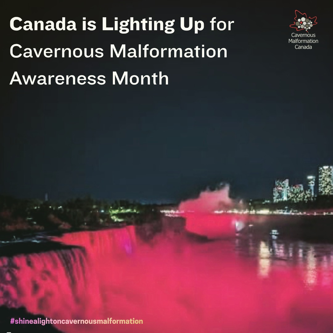 In June, we shine a light on cavernous malformation across Canada in various forms, including lighting up landmarks in red across the country. We shine a light on our need for research, clinical trials and funding commitments for these. We highlight the barriers to diagnosis and care and most of all, we honour the people impacted by this rare disease every single day-without a cure and limited treatment options.
Shine a light on cavernous malformation this June to bring it into the spotlight. Even a small act like sharing posts, talking to your friend or colleague about the disease, or sharing in the lighting events reminds us that together we can increase awareness.
The lighting schedule is below and in our bio:
Manchester Square Edmonton-June
Province House-Halifax-June 4
Sydney City Hall-Sydney-June 4
Sasktel Centre-Saskatoon-June 4
Sylvan Lake Lighthouse-June 5
Calgary Tower-June 7
Aurora Town Hall-June 8
Mississauga Clock Tower-June 8
Hamilton Signature Sign-June 9
Peterborough City Hall-June 9-11
Nanaimo Bastion-June 9-10
London City Hall-June 12
Canada Life/JA Taylor-London-June 12
RBC Building-London-June 12
CN Tower-June 13
Niagara Falls-June 14 at 1015PM
Barrie Heart Sign-June 14
Peace Bridge-June 15
Saskatoon City Hall and Prairie Wind-June 16-17
Fred Lundy Bridge and River Walk Commons Newmarket-June 16
High Level Bridge Edmonton-June 18
Alberta Legislature-Edmonton-June 18
Fairmont Macdonald -June 18
Sails of Light Vancouver-June 19
NFLD Confederation Building-June 19
Vancouver Convention Centre-June 20
Olympic Cauldron Vancouver-June 20
Bracebridge Falls-June 22-26
Esplanade Riel Bridge/Winnipeg Sign- Winnipeg June 22
Maple Ridge City Hall-June 17
Moncton City Hall-June 26
Moncton Downtown/Downing St/Avenir Place June 26
British Columbia Legislature-June 27
Charlottetown City Hall-June 28
Shaw Building Charlottetown-June 28
Vancouver City Hall-June 28
Burrard St. Bridge Vancouver-June 28
..and more coming!
#cavernousmalformation #cavernoma #canada #cavernousmalformationawarenessmonth #raredisease #igniteawareness #shinealightoncavernousmalformation