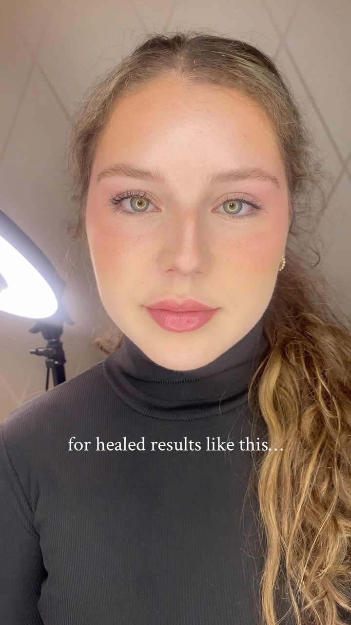 Whilst I don’t always recommend a lipstick effect, it can absolutely work for some clients. But you do need to be prepared for it to look darker, bolder and potentially a little more swelling than if you were to get the tint version.
Got questions? My DMs are always open or you can book a free consultation at the link in bio for any of our cosmetic tattoo services 🧚♀️
Southport, Gold Coast 📍