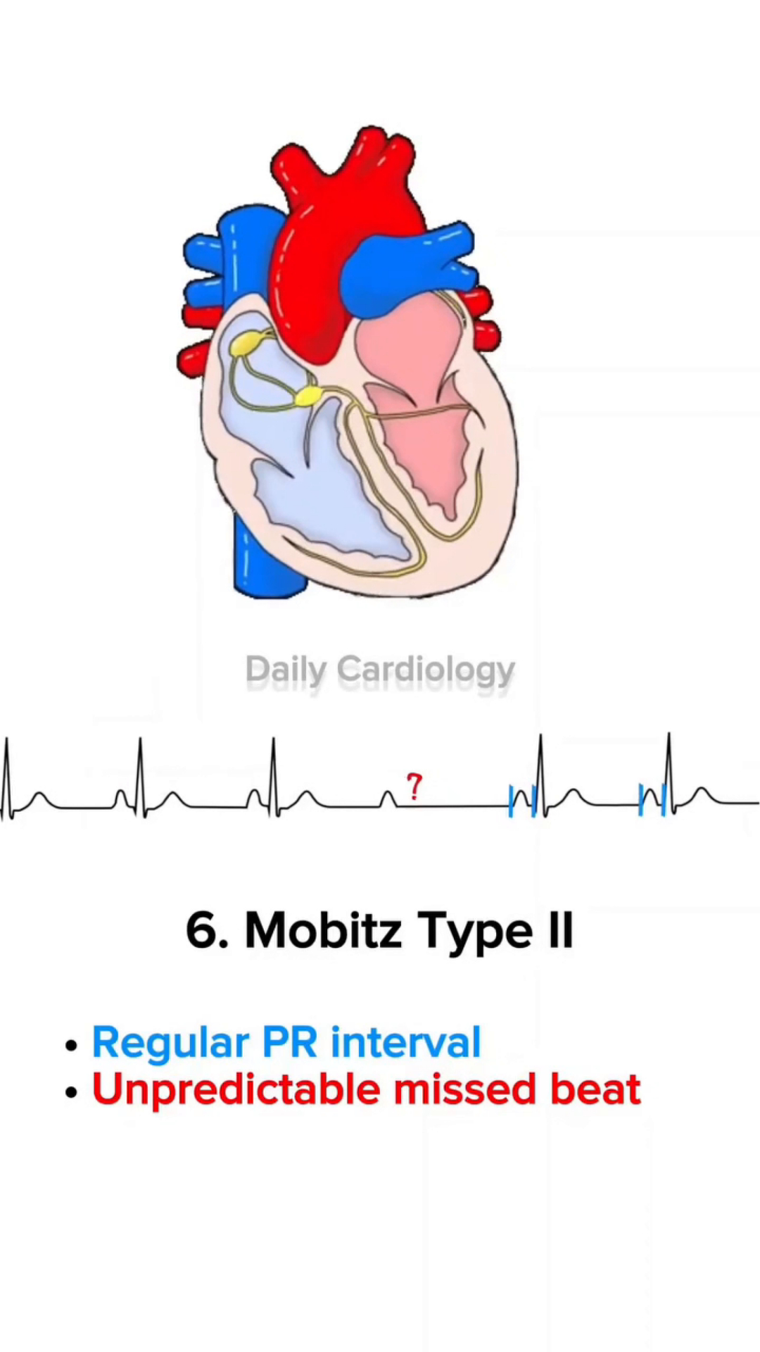 REPOST: Daily_Cardiology Official: Instagram, Facebook
Daily_Cardiology
Welcome to Daily Cardiology !🔥 Your go-to source for expert insights on heart health & cardiology.❤️ linktr.ee/you
Junte-se a Daily_Cardiology hoje no Linktree
Instagram
YouTube
Instagram
Facebook