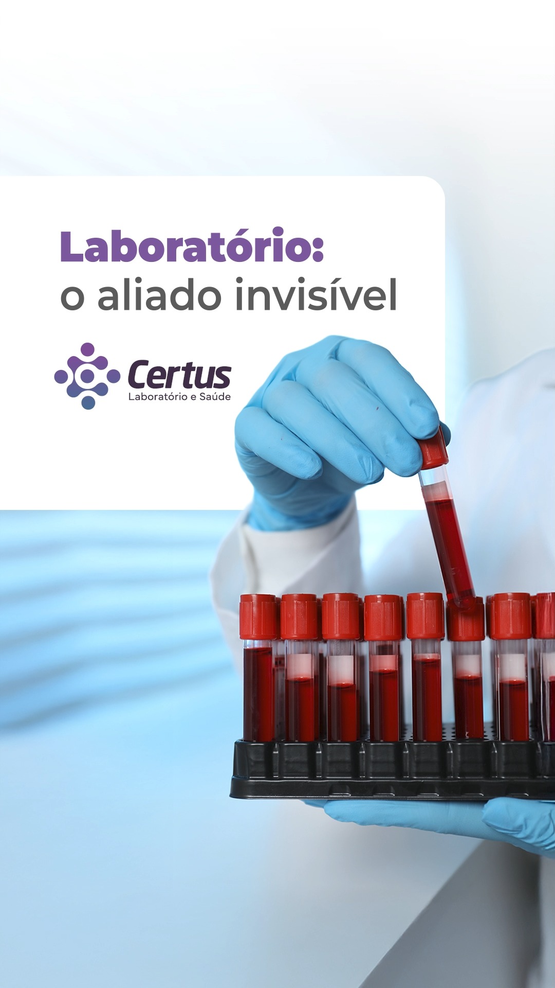 🤔 Você já parou pra pensar em tudo o que acontece antes de um diagnóstico?
Por trás de cada decisão médica, existe uma equipe de laboratório que analisou amostras com responsabilidade e tecnologias de ponta. É nessa etapa que sintomas são explicados, o que ajuda a direcionar o cuidado com mais segurança.
Fale conosco e saiba mais sobre como podemos ajudar você a cuidar da saúde.
Certus Laboratório e Saúde
📍 Piumhi (Centro)
Praça Guia Lopes, nº 54, Anexo à Santa Casa
📞Telefone: (37) 3371-9511
📱WhatsApp: (37) 99965-0200
📍 São Roque de Minas
Rua Francisco Alves Oliveira, 230, Centro
📱📞Telefone/WhatsApp: (37) 99991-0500
Site: www.certuslaboratorio.com.br
🕐 Horário de funcionamento:
Piumhi:
Segunda a sexta: das 6h30 às 19h
Sábado e feriados: das 7h às 19h
Domingo: das 7h às 13h
São Roque de Minas:
Segunda a sexta: das 6h30 às 17h30
Sábado: das 7h as 11h