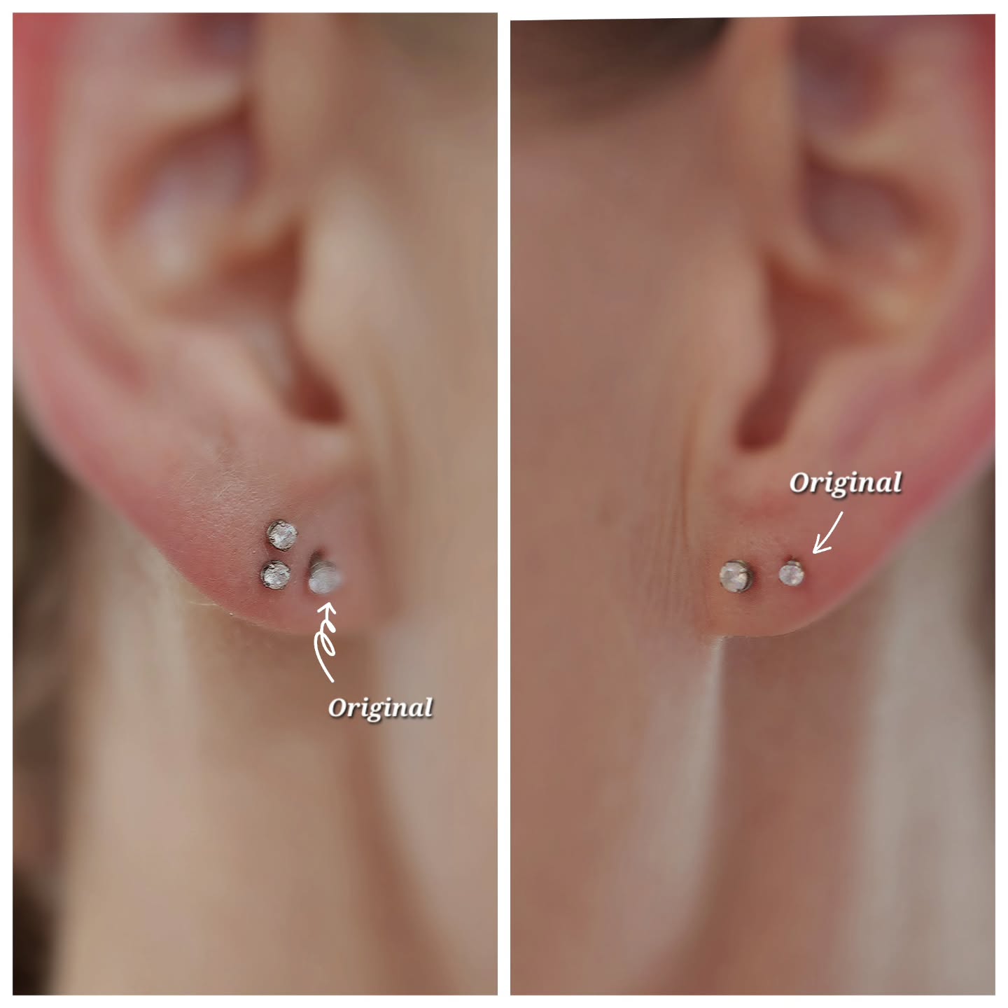 They came in a while back to get their lobes fixed because one was much further out than the other.
We added a new single piercing to the left with a 2.5mm prong set gem from @junipurrjewelry, and a stacked lobe to the right using two 2mm prong set gems from @junipurrjewelry.
I never remember to take pics when clients come back with healed piercings and I'm trying to be better about that, and about just taking photos in general.