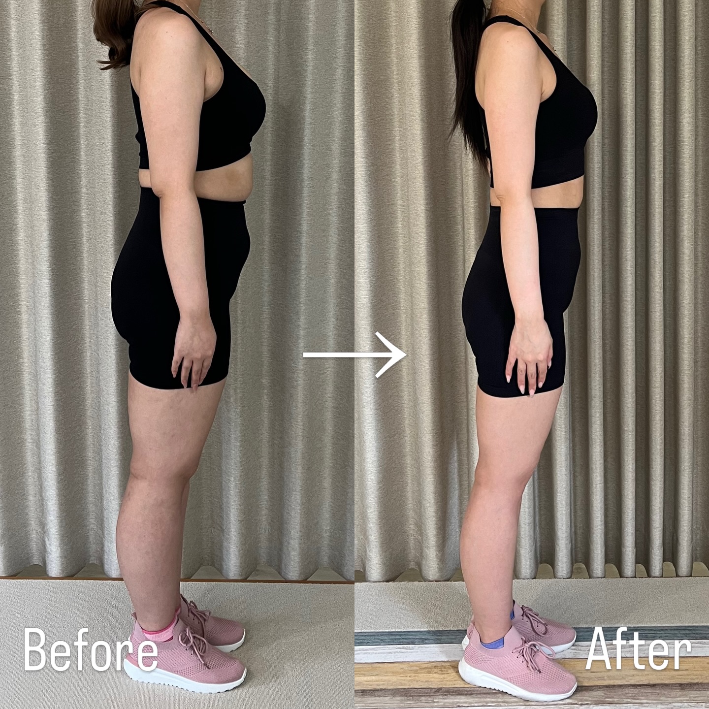 【BeforeAfter】
お客様K様✨
素晴らしい変化です👏
K様は始めの数ヶ月のみお食事指導をさせていただきました!
そこからはご自身でお食事を行いつつ週2回のトレーニングを継続的に続けられておられます💪
そして...
ここからさらに美しいお身体になる為に全体のバランスを再度みさせていただきながらK様に必要な種目を厳選しメニュー変更をしていきます☝️
トレーニングをしているとお身体は日々少しずつ変わっていきます✨
同じことばかりをするのではなくお身体の変化に合わせてメニューを作り直していくことも美しいお身体になる為のとても大事なこととなります☺️
これからの変化が楽しみです🍑いつも楽しいお時間をありがとうございます!
体験¥3,000/60min
n.bodymakeでは健康で美しい身体づくりへのお手伝いをさせていただいております。
✼••┈┈┈┈┈┈┈••✼••┈┈┈┈┈┈┈••✼
ジム
@n.bodymake.2024
宮崎市阿波岐原町前浜4276-451
問合せ方法 : 公式LINEにてご連絡ください。
⋆⸜完全プライベート🕊⸝⋆
⚫︎女性専用
⚫︎ "美尻"美脚"特化型
⚫︎ヒップ専用マシーン完備
⚫︎ペアでの運動も可能
⚫︎お子様連れOK
⚫︎広々とした駐車場を完備
豊富なプランをご用意しております。
✼••┈┈┈┈┈┈┈••✼••┈┈┈┈┈┈┈••✼
#nbodymake #宮崎市パーソナルジム #宮崎市パーソナルトレーニングスタジオ #宮崎市女性パーソナルジム#宮崎市プライベートジム宮崎市キックボクシングジム