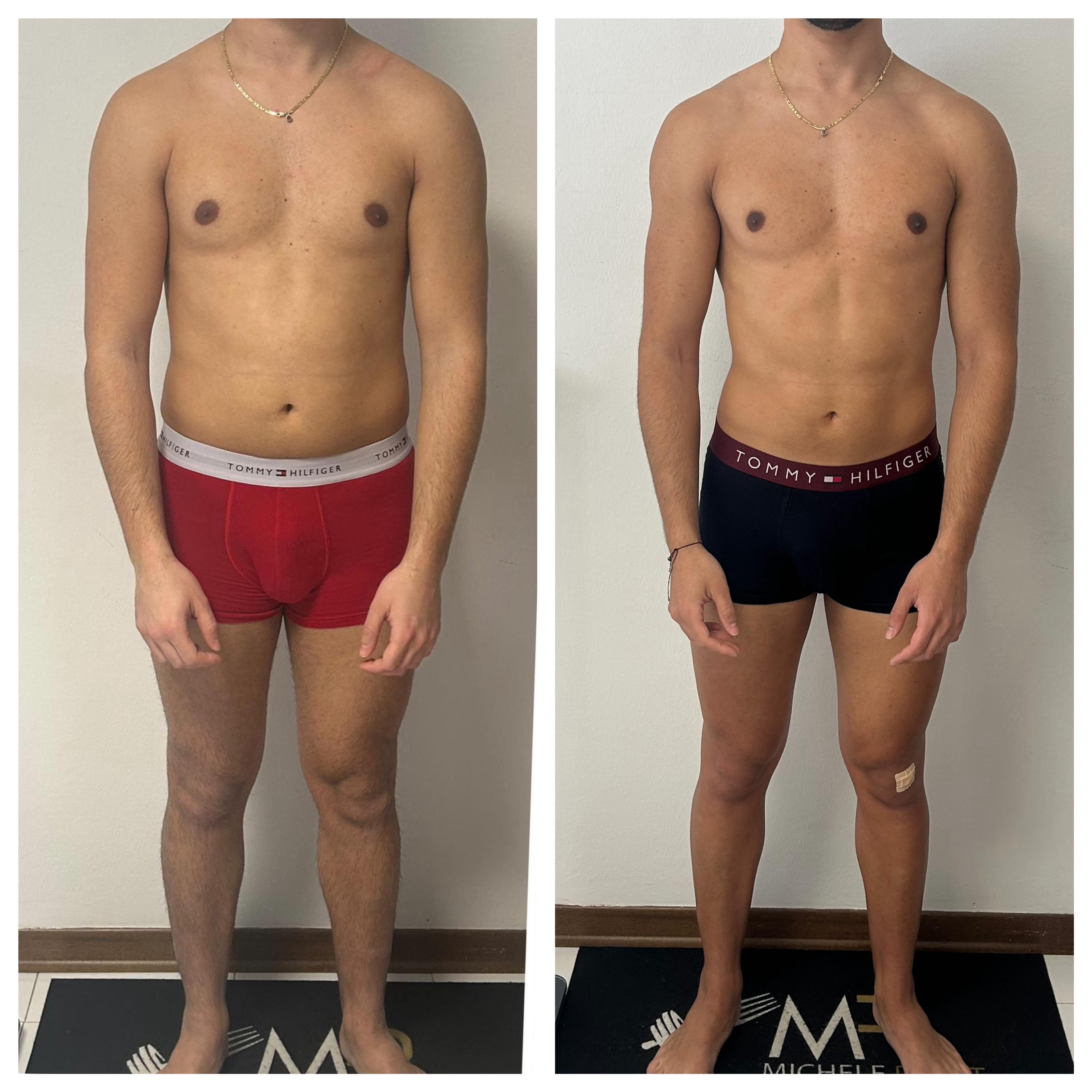 ⚠️⚠️⚠️ work in progress!
In collaborazione costante con @vsantagati_trainer con il quale ci ritroviamo spesso a collaborare per dare un servizio a 360^ e pieno supporto atletico e alimentare.
In questo caso il ragazzo della foto si presenta da me a metà marzo con l’esigenza di migliorare la propria condizione fisica tenendo conto di un lavoro pesante su turni anche notturni.
Il risultato è stato eccellente, non solo a livello di cm , di grasso e di forme, ma soprattuto a livello di prestazione in allenamento e di gestione delle energie a lavoro.
Ora a settembre ci aspetterà una seconda fase dove alzeremo sicuramente le calorie per ottenere ancora più risultati!
Bravissimo 💪💪💪💪
È un ringraziamento a @vsantagati_trainer per condividere con me i suoi atleti!
#check #nutrizione #nutrizionista #work #cagliari
