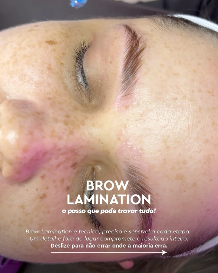 A Brow Lamination não aceita "achismos" 🧐
Por ser um procedimento que altera a estrutura capilar, ele não perdoa falta de atenção.
Se você aplica o Passo 1, responsável por amolecer a estrutura do fio, e se perde esperando o tempo da embalagem passar, você está jogando com a sorte e com a sobrancelha da sua cliente 👀
O tempo recomendado pelo fabricante é apenas um direcionamento, não uma regra universal. Fios grossos, finos, porosos ou virgens reagem em velocidades completamente diferentes🎯
Para que a laminação não "trave" e o resultado não seja um fio elástico ou que volte ao normal no dia seguinte, você precisa dominar a técnica e ter uma boa observação.
📝O Teste de Maleabilidade é o seu maior aliado para saber a hora exata de remover o produto e neutralizar a química, e esta tudo bem conferir o procedimento, pois cada cliente precisa de um atendimento personalizado.
Entenda o comportamento do pelo e você nunca mais terá medo de entregar uma Brow Lamination perfeita, alinhada e, acima de tudo, saudável!
Salve este post e compartilhe com aquela colega de profissão sobre nossas dicas! 🫰🏼✨
.
.
#refectocilbrasil #theworldinyoureyes #browlamination #designdesobrancelhas
@academiarefectocil @refectocil_international
