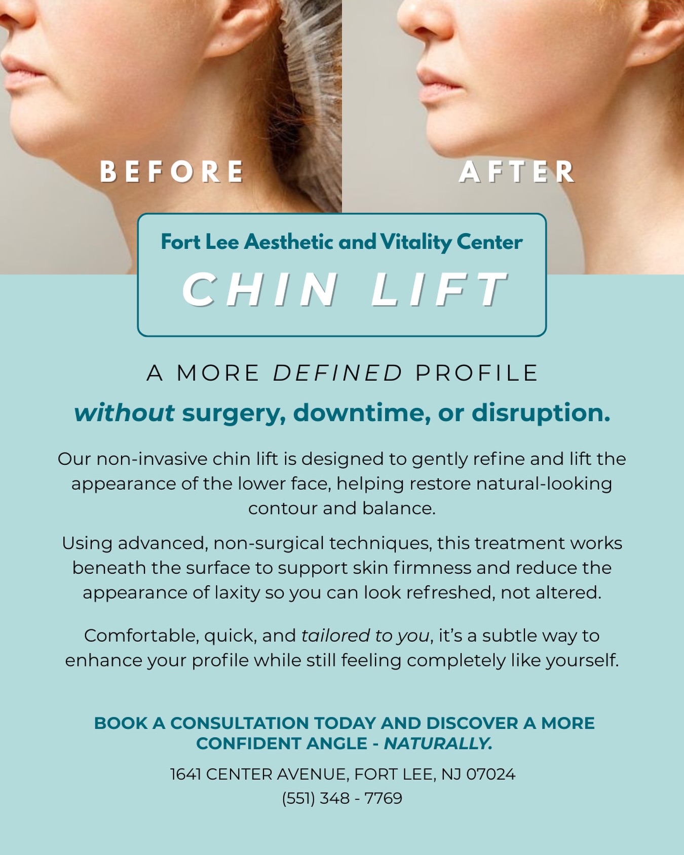 A refreshed profile doesn’t have to come from something dramatic. Sometimes, it’s about subtle enhancements that help your natural features feel more balanced and supported.
The non-invasive chin lift at Fort Lee Aesthetic and Vitality Center is designed to gently improve definition in the lower face with a comfortable, no-downtime approach - ideal for anyone looking for a soft, natural-looking refinement.
If you’ve been curious about options to enhance your profile in a low-commitment way, a personalized consultation can help you explore what’s possible.
✨ Book your visit today and take the first step toward feeling more confident in your look.
#fortleenj #chincontouring #facialrejuvenation #fortleeslimcenter #naturallookingresults