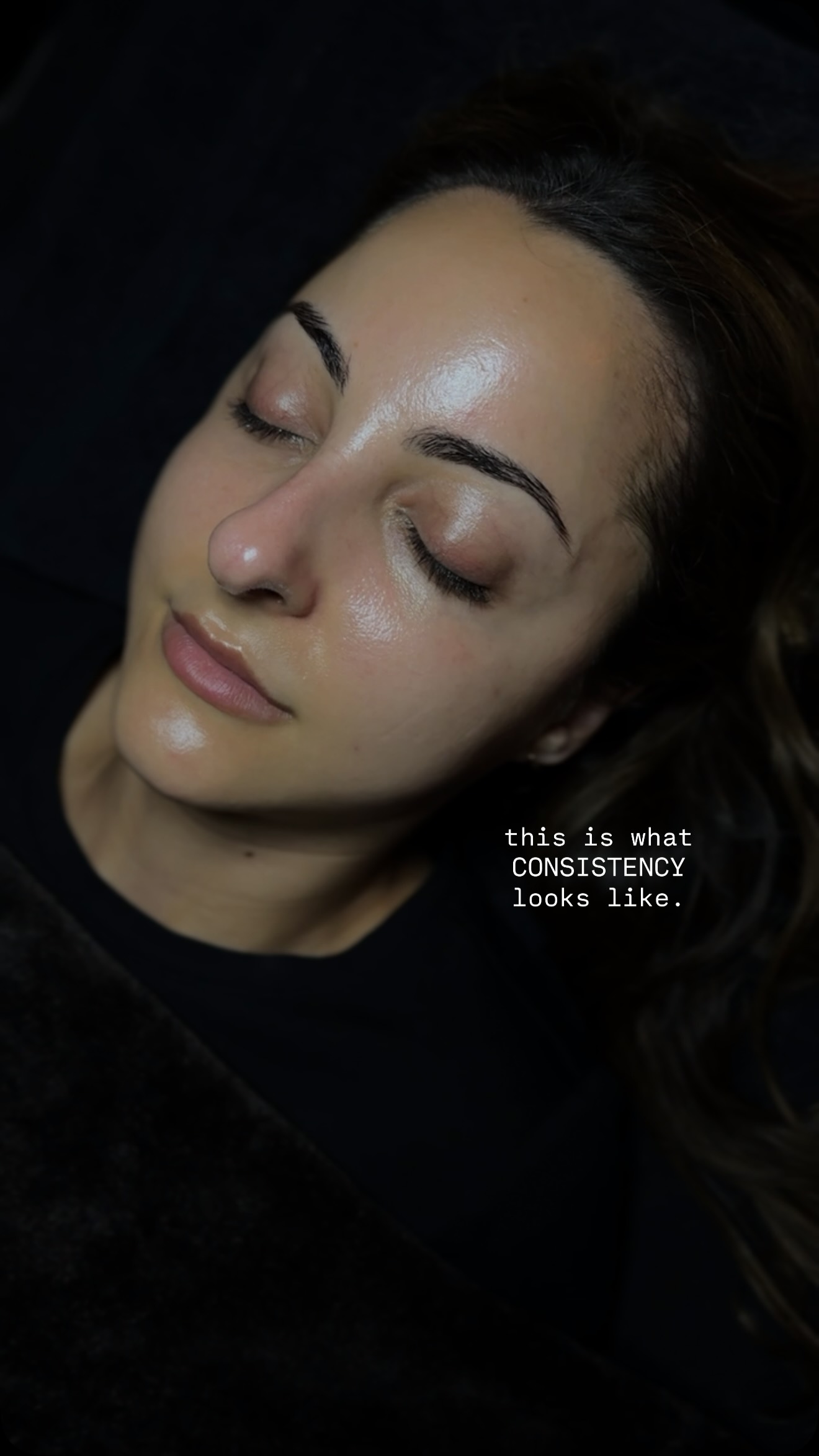 Diamond Glow Facials, Microneedling treatments and a disciplined skincare regimen at home.
Glass skin all day, every day, never use filters again.
