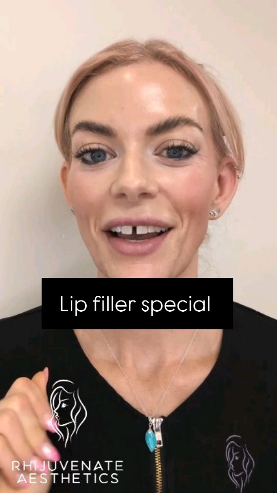 Don't miss my June special offer
📱07903078274
📩admin@rhijuvenateaesthetics.co.uk
📍GU32 3EW
✨Complimentary consultations
💉 20 years medical background
#aestheticsinjector #aestheticshampshire #petersfield #lips #lipfiller