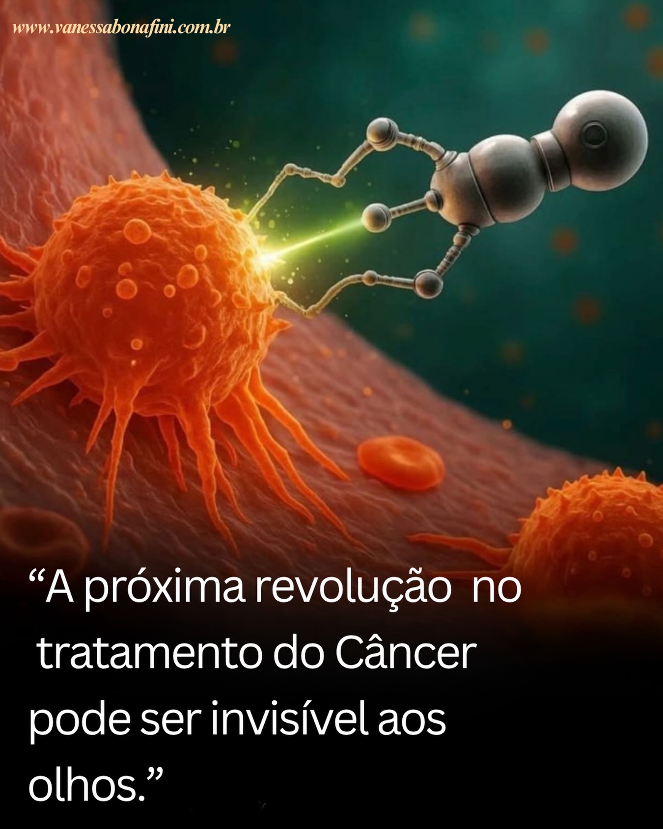 Imagine um tratamento contra o câncer que encontra o tumor com muito mais precisão, preservando tecidos saudáveis ao redor.
É exatamente isso que a nanotecnologia está ajudando a tornar realidade.
Os tratamentos convencionais muitas vezes circulam por todo o corpo, atingindo tanto células doentes quanto saudáveis. Já os sistemas de entrega baseados em nanopartículas funcionam como “transportadores inteligentes”, capazes de levar medicamentos diretamente ao local onde são mais necessários.
O que isso pode significar?
• Maior precisão no tratamento
• Menos efeitos colaterais
• Melhor absorção dos medicamentos
• Possibilidade de terapias personalizadas
• Novas estratégias para imunoterapia e vacinas contra o câncer
Hoje, algumas nanopartículas já são utilizadas em medicamentos aprovados. E os pesquisadores estão avançando ainda mais, desenvolvendo sistemas guiados por inteligência artificial, terapias baseadas em mRNA e vacinas personalizadas para cada paciente.
A próxima revolução na oncologia talvez não seja apenas descobrir um novo medicamento.
Talvez seja aprender a entregar o medicamento certo, no lugar certo, na hora certa.
O futuro da medicina pode estar sendo construído em escalas tão pequenas que não conseguimos enxergar, mas com potencial para transformar milhões de vidas.
💬 Você já tinha ouvido falar em nanotecnologia aplicada ao tratamento do câncer?
1. National Cancer Institute – Nanotechnology in Cancer Research Program (Alliance for Nanotechnology in Cancer).
2. U.S. Food and Drug Administration – Guidance and regulatory considerations for nanomaterials in drug products.
3. Mitchell MJ et al. Engineering precision nanoparticles for drug delivery. Nature Reviews Drug Discovery. 2021;20:101–124.
4. Shi J et al. Cancer nanomedicine: progress, challenges and opportunities. Nature Reviews Cancer. 2017;17:20–37.