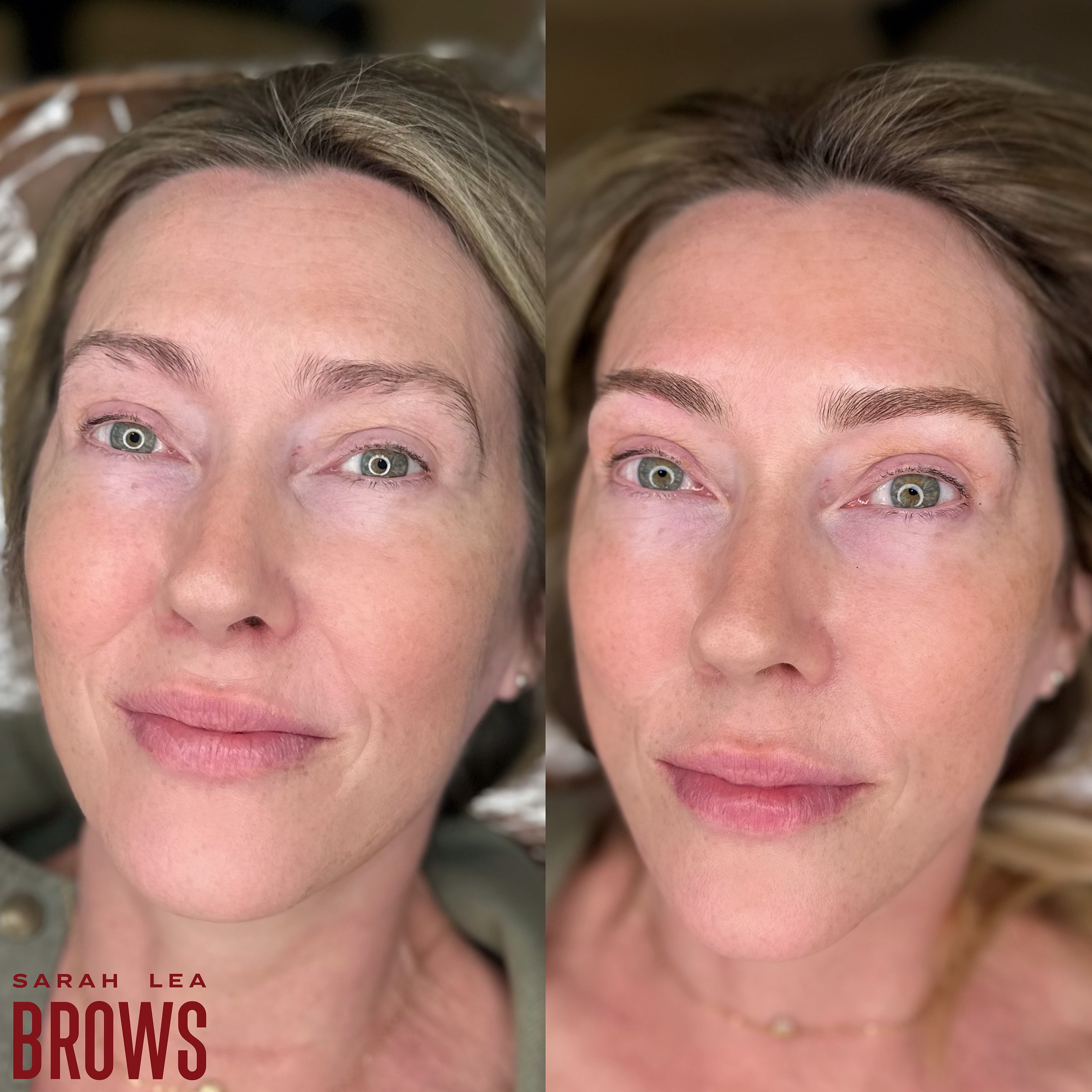 Perfect frames for a perfect face and the update she needed to bring everything together 🪄
Link in bio to book 👀
~ Soft Ombre
~ Lasts 2+ years
~ Appears around 40% darker and bolder for the first week but heals to a beautiful soft finish that gives the same look as brow pencil or powder would.
~ Artist: Sarah Lea
~ Suitable for all skin types
~ Southport, Gold Coast 📍
~ Bookings & Info:
www.sarahleabrows.com