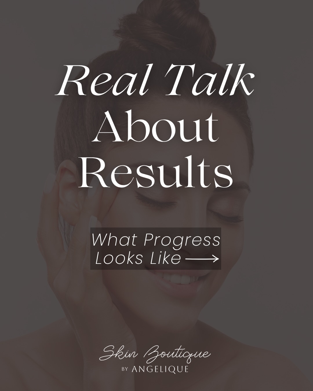 I will always be honest with you. We set clear goals and keep the routine realistic, and check in often and pivot when needed. Your skin deserves a partner who tells the truth and celebrates every win with you. That is what you get in my studio!
๐ (512) 293-1778
๐ skinboutiquebyangelique.com
๐1102 S. Rock St. Suite 3, Georgetown, TX
*
*
*
*
#georgetowntxskincare #summerfacial #skinrefresh #glowingskin #hydratedskin facialseason skinrescue centraltexasesthetician glymedplus hydrinityskincare