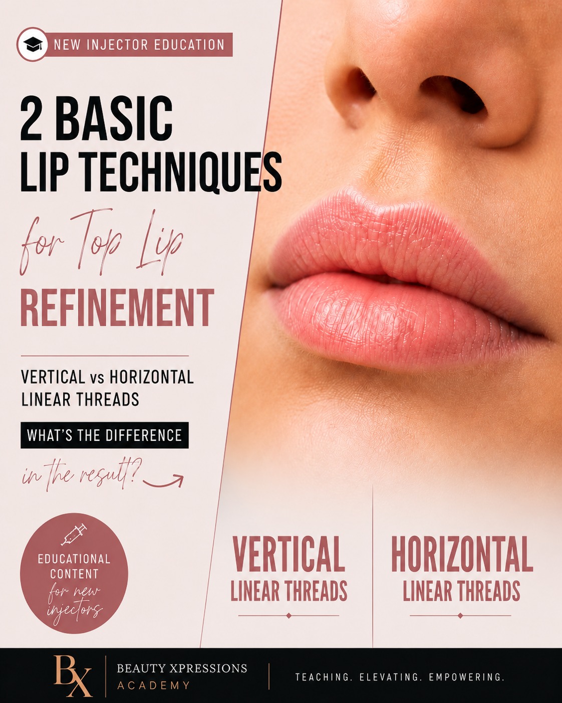 A quick educational clip for newer injectors learning how small technical choices can influence the final lip result. 💉
In this reel, I’m reviewing two basic top lip refinement techniques: **vertical linear threads** and **horizontal linear threads**.
These are not advanced or “new” techniques for seasoned injectors, but they are foundational skills that can help newer injectors understand how product placement, direction, and tissue support can subtly change the shape, definition, and overall refinement of the upper lip.
As always, technique selection should be based on anatomy, assessment, patient goals, product choice, and safe injecting principles — not a one-size-fits-all approach.
Educational content only. Technique selection depends on anatomy, tissue capacity, product choice, depth, clinical assessment, training, and scope of practice. This content is not individualized treatment advice and does not replace hands-on education, supervision, or clinical judgment.
#medicalaestheticstraining #injectoreducation #lipfillereducation #aestheticnurse #beautyxpressions