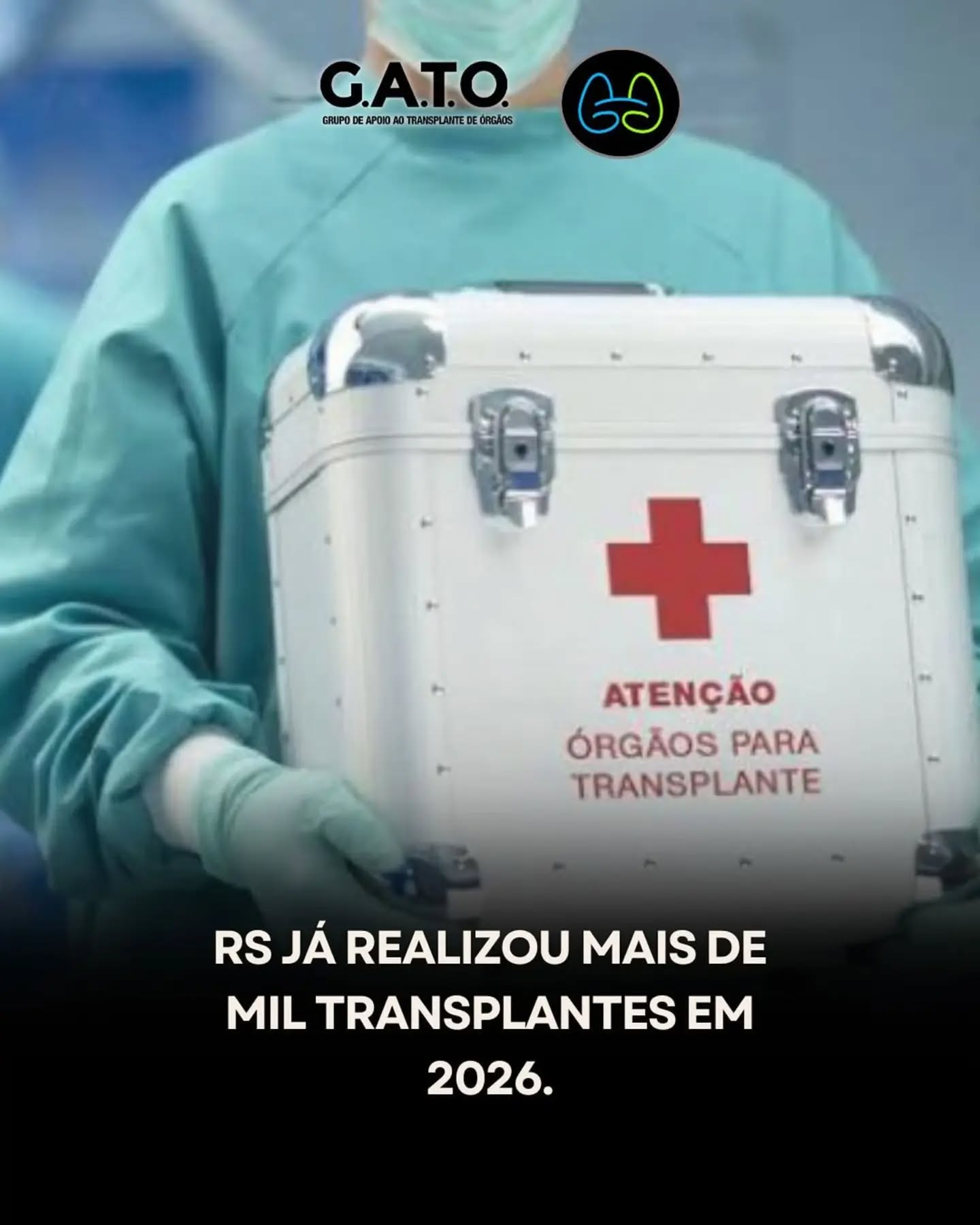 Repost: @transplantesrio
O Rio Grande do Sul já realizou mais de mil transplantes em 2026, de órgãos e tecidos, segundo dados da Central de Transplantes da Secretaria Estadual da Saúde (SES/RS). Atualmente, quase 3 mil pessoas aguardam na fila por procedimentos do tipo no estado.
O número de transplantes no RS tem crescido consistentemente: em 2025, foram 2.446 transplantes de órgãos e tecidos, aumento de 8% em relação a 2024 (2.257 procedimentos), e o estado ficou em 5º lugar no ranking nacional entre os 26 estados e o Distrito Federal.
Em 2024, mesmo com a calamidade climática que atingiu o estado, foram 1.634 transplantes de órgãos, aumento de 5,6% em relação a 2023, incluindo 557 de rim, 882 de córnea, 134 de fígado, 35 de pulmão e 26 de coração.
A Santa Casa de Porto Alegre é a principal referência em transplantes no estado: em 2025, realizou 469 dos 773 transplantes de órgãos gaúchos, mais de 60% de todos os procedimentos, e em janeiro de 2026 registrou 59 transplantes em um mês, o maior volume mensal dos últimos 10 anos.
#TransplanteDeÓrgãos #GATO #DoeÓrgãos #ConverseComSuaFamília