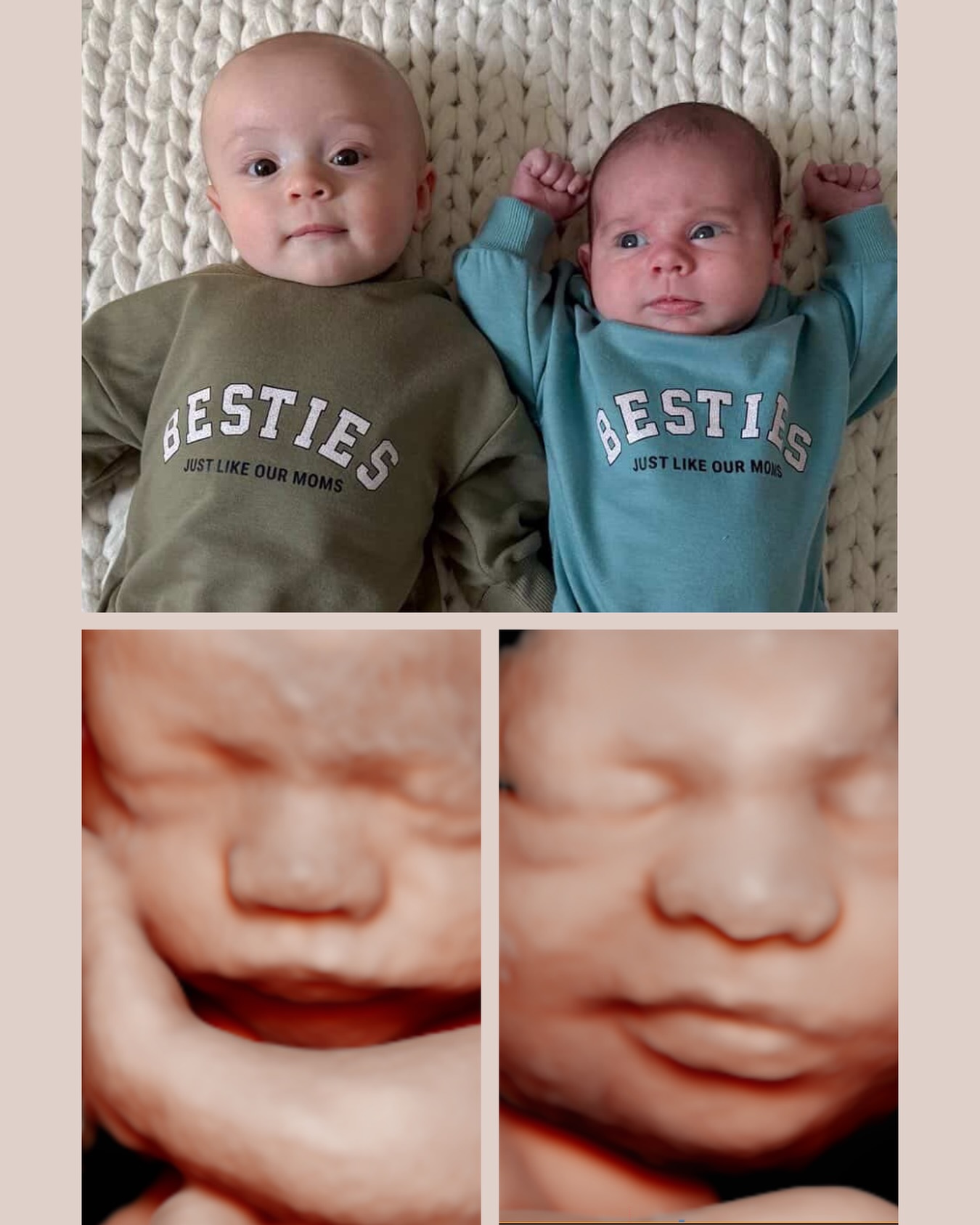 Getting to watch one baby grow is special. Getting to watch two best friends grow their baby boys together is something even more special. from womb to world 😭🩵