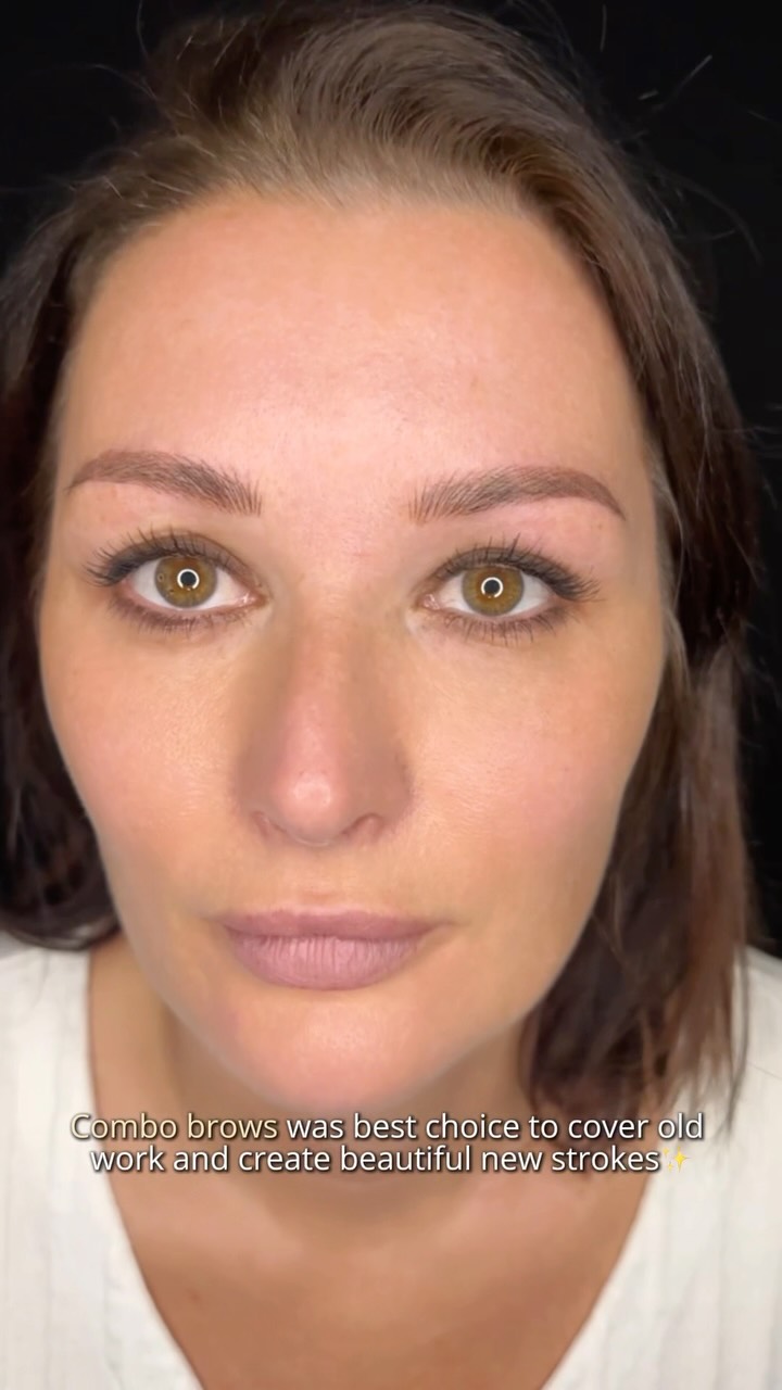 Every correction requires an individual approach, and that’s what makes all the difference 🤍
In this case, Combo Brows after the laser removal were the perfect choice. The combination of soft shading and delicate hair strokes helped seamlessly blend the remaining pigment while creating a fresh, balanced, and natural-looking result.
No two correction cases are the same. The best results come from choosing the right technique for your skin, your previous work, and your desired outcome ✨