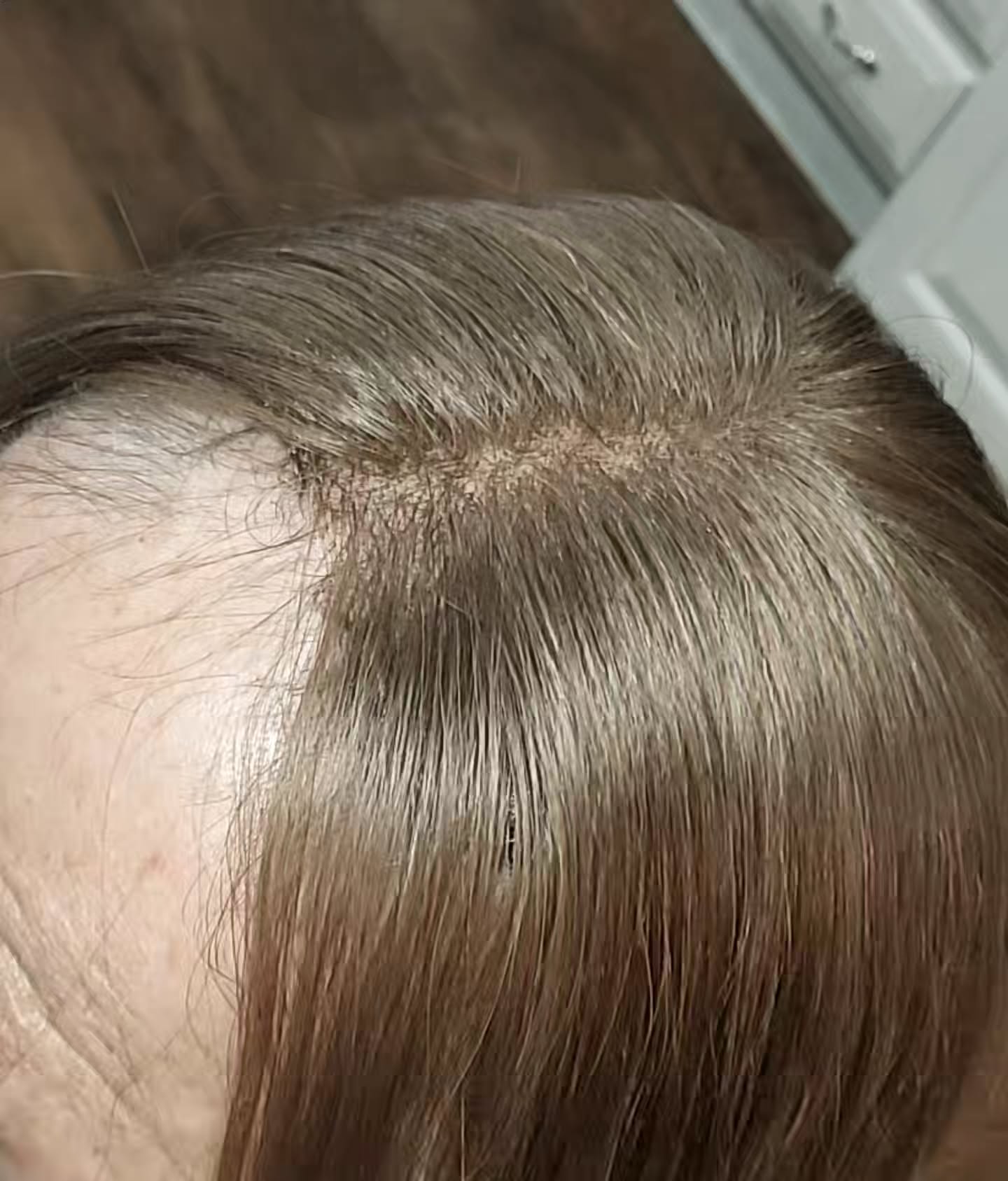 Close up of a Custom Crown
One of our hair replacement options at Vista Belle Salon if you're thin in the crown/top of your hair. This is a comfortable & healthy hair topper that's and affordable option, easy to take care of and doesn't feel heavy or hot.
Its super realistic and natural and will instantly give you your confidence back
For inquiries, book a custom crown consultation through our online booking
More details on our website www.vistabellesalon.com