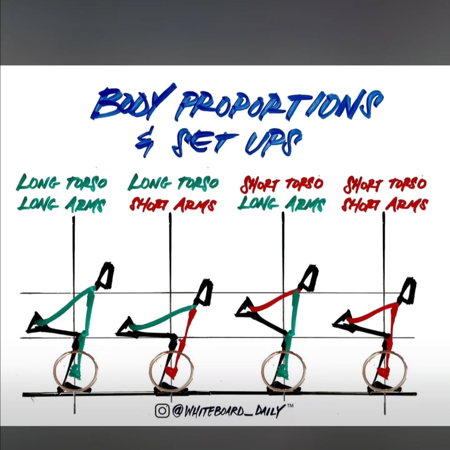 Think Olympic lifting is only for a specific body type? Think again. π
ββοΈ
If you look at the screen and see elite lifters who look nothing like you, it is easy to feel like the Snatch or Clean & Jerk "isn't for your body." But the truth is, Olympic lifting belongs to everyone.
Your skeleton is unique. Maybe you have long legs, short arms, or a tight back. That doesn't mean you can't liftβit just means your setup will look different than the person next to you. π§¬
That is exactly why we don't use cookie-cutter coaching here:
π οΈ We modify the setup: If your femurs are long, we adjust your hip height and footprint to clear your knees safely.
π We adapt the grip: If your arms are long, we find the exact hand width to keep the bar in your power position.
π§ββοΈ We scale the depth: If your mobility is a work in progress, we catch in a power position or use blocks while you build strength.
You don't need the "perfect" genetic levers to lift weights. You just need a coach who knows how to make your unique anatomy work for you.
Our coaches are here to help you decipher your body's blueprint so you can lift safely, powerfully, and with total confidence. π¦Ύ
Ready to find your perfect setup?
Send us a DM or tap the link in our bio β¬οΈ
#crossbarnsley #olympiclifting #coaching