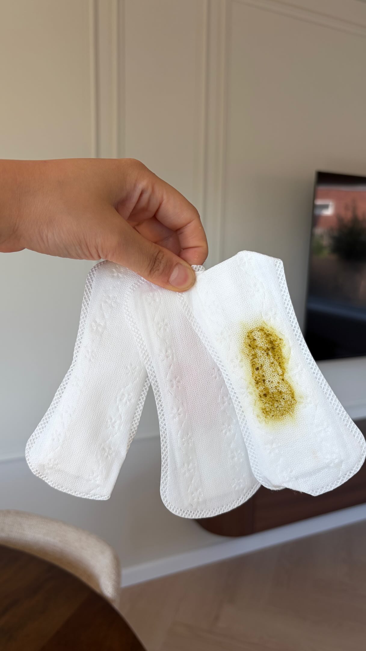 Bij ongeveer 10% van de zwangere vrouwen begint de bevalling met het breken van de vliezen. 💧
En nee, dat is niet altijd zoals in films met ineens een enorme plas vruchtwater. Soms verlies je juist de hele dag kleine beetjes, bijvoorbeeld bij opstaan, lopen, niezen of lachen. Dit komt vaak doordat het hoofdje al mooi is ingedaald en als het ware tegen de baarmoedermond drukt, waardoor het vruchtwater minder makkelijk naar buiten komt.
Let altijd goed op de kleur van het vruchtwater:
• Helder of lichtroze → normaal
• Kan wat zoet ruiken en soms witte vlokjes bevatten → ook normaal
• Groen → dan zit er meconium (ontlasting van de baby) in het vruchtwater
Groen vruchtwater zien we vaker rond 41-42 weken, wanneer de darmen van de baby wat “rijper” zijn. Soms is het onschuldig, maar het kan ook wijzen op stress bij de baby. Daarom vindt verdere controle plaats in het ziekenhuis, waar de baby continu gemonitord wordt met een hartfilmpje.
#gebrokenvliezen #vruchtwater #verloskundige