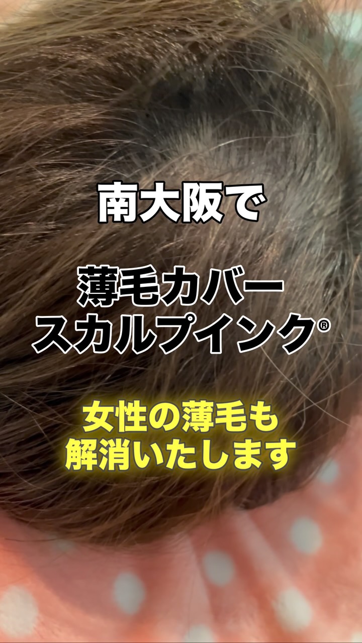 女性も大丈夫です⭐️
その薄毛、まずは“スカルプインク®“が自分に合うのか、から試しませんか?
当店では、皆様に安心して試していただけますように。初回施術で定着適性を見極め、万が一合わない場合は半額返金保証いたします。
無理に続けさせることはありません。結果に自信があるから、この仕組みです。
👉まずは“あなたに合うか”を確認してください。
【初回適正診断保証(半額返金)】
初回施術後、頭皮状態や色素の定着を確認し、当店基準で継続が難しいと判断した場合、初回施術費用の半額を返金いたします。
※以下の場合は対象外
・当店が継続可能と判断した場合
・お客様都合による中断など
・デザインの好みによる不満など
・アフターケア未実施など
──────────────────────
髪が薄くなると、見た目だけでなく気分まで沈みがち。
でも、もう一人で悩まなくて大丈夫です。
前髪・つむじ・分け目。
どこから見られても怖くない自然な仕上がりへ。
スカルプインク®は極小ドットで濃さを再現する
“最もバレにくい”頭皮タトゥー技術。
・痛みほぼなし/麻酔不要
・色落ちしにくい専用インク
・即日変化を実感/男女対応
産後脱毛・円形脱毛・傷跡にも対応。
──────────────────────
※美容師歴20数年の認定アーティストが責任を持って施術します。
※この地で開業18年となります、ご安心してお任せください。
大阪・和泉市|THREE BRANCHES
✨今なら3.3万発
49500円が33,000円(税込)
今なら何度でも‼️
📩公式LINEでご相談ください。
#スカルプインク
#薄毛対策
#南大阪
#つむじ
#頭皮タトゥー
※大阪で薄毛で悩まれている男性も女性も
ぜひ1度お声掛けください。