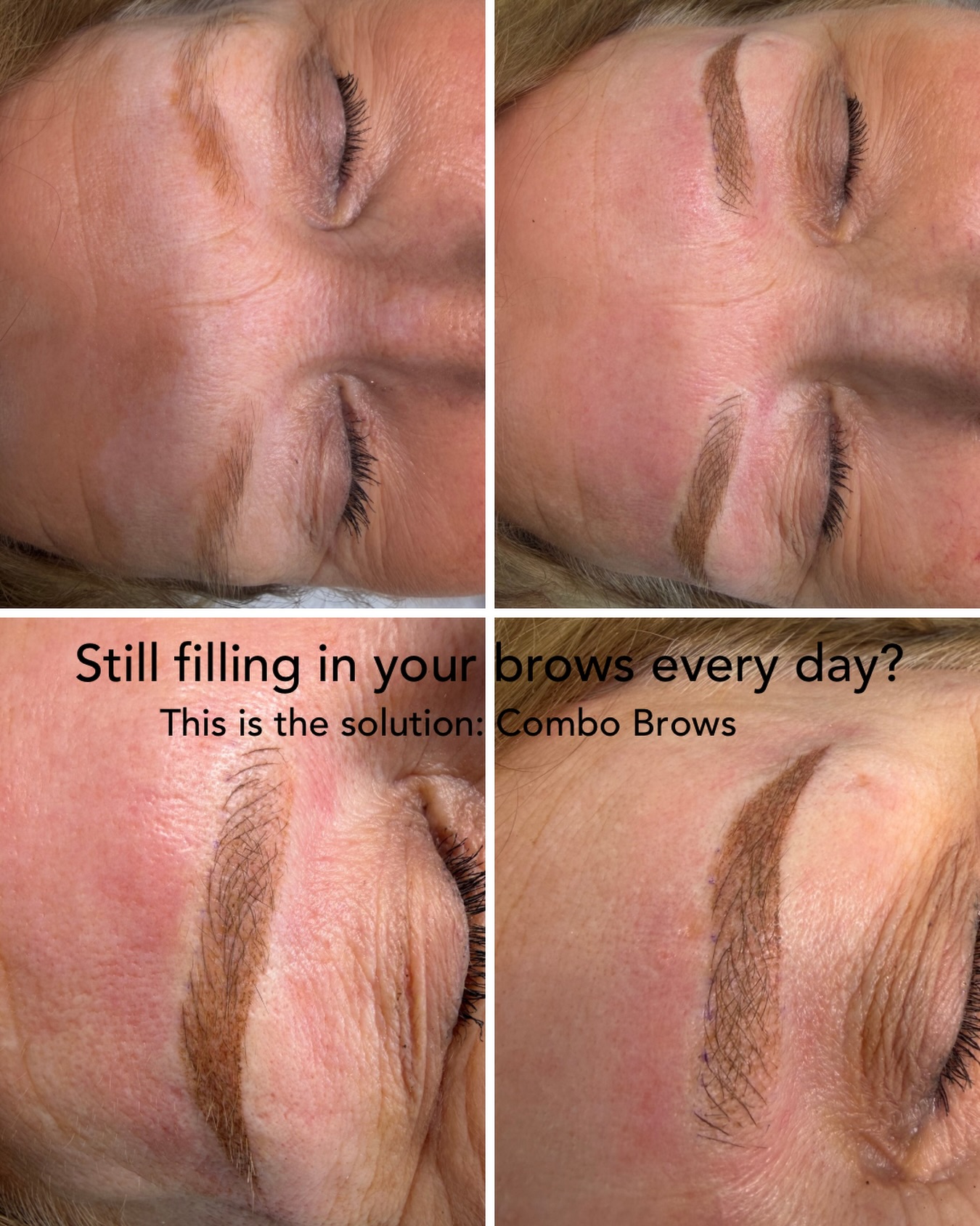Tired of filling in sparse brows every morning? ✨
Combo Brows combines Microblading + Shading to create fuller, natural-looking brows that last.
Supplies from @cosmedic_supplies
Wake up ready every day.
Limited appointments available this month.
Book online now 🤍
www.belenspmustudio.com
info@belenspmustudio.com
#combinationbrows #spmu #pmuuk #cardiff #belenspmustudio