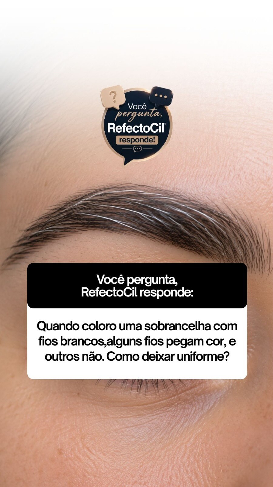 Quando coloro uma sobrancelha com fios brancos, alguns fios pegam cor e outros não. Como deixar uniforme?
Essa dúvida é muito mais comum do que parece, e você pergunta, RefectoCil responde!
O fio branco tem a cutícula mais fechada e resistente do que o fio pigmentado, a solução é preparar os fios brancos antes de colorir, usando uma dessas duas técnicas que sempre falamos aqui pra vocês, porque preparar o fio não é etapa extra, é o que garante o resultado uniforme que a sua cliente espera!
Gostou da dica? Compartilhe com suas amigas que precisam saber mais!
Tem alguma dúvida? Manda aqui nos comentários que a RefectoCil responde!
.
.
#refectocilbrasil #theworldinyoureyes #tinturadesobrancelhas #fiobranco #mordacagem
@academiarefectocil @refectocil_international