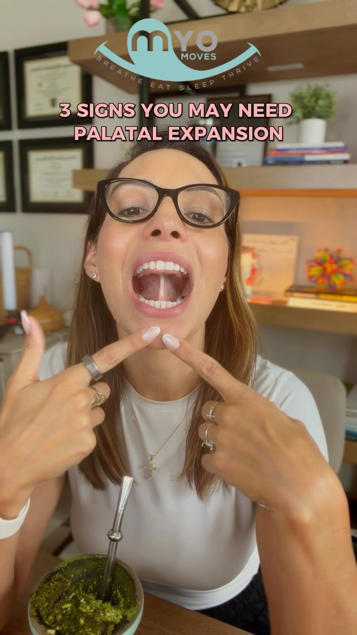 🚨 3 signs your jaw may not have developed to its full potential 🚨
Many people think a narrow palate is just about crowded teeth, but it can impact tongue posture, breathing, chewing, sleep, and overall airway health.
Here are 3 common signs I look for:
✔️ Dark buccal corridors (the “black hallways” you see when someone smiles)
✔️ A posterior crossbite (upper teeth sitting inside the lower teeth)
✔️ A tongue that overflows onto the chewing surfaces of the teeth when suctioned to the palate
One of the biggest misconceptions is that the tongue is “too big.” More often, the tongue is normal-sized, but the jaws didn’t grow wide enough to properly accommodate it.
Palatal expansion may be an important part of creating more space for the tongue, supporting nasal breathing, and improving overall oral function.
Remember, expansion isn’t just about the appliance. A myofunctional therapist can help guide you through the process, optimize tongue posture and function, and support long-term stability throughout your airway journey.
Thinking about palatal expansion for yourself or your child?
Comment EXPANDME and we’ll send you information about how myofunctional therapy can support your expansion journey. 👇
#PalatalExpansion #AirwayHealth #MyofunctionalTherapy #breathebetter #MouthBreathing NasalBreathing Crossbite TongueTie PediatricAirway AdultAirway