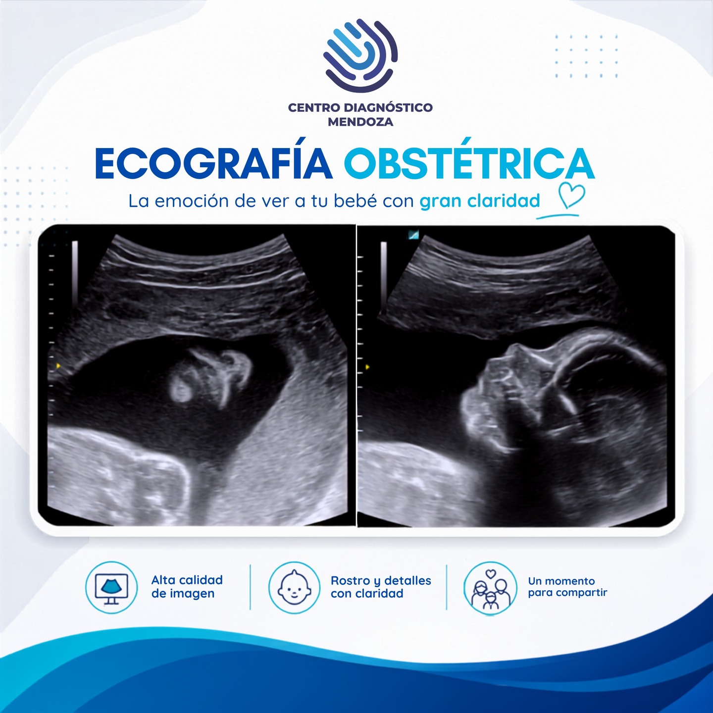 Ver a tu bebé por primera vez es un momento único 🤍
En Centro Diagnóstico Mendoza realizamos ecografías obstétricas con imágenes de alta calidad, para que puedas vivir la emoción de ver su rostro, sus movimientos y cada detalle con gran claridad.
Un estudio pensado para acompañarte durante el embarazo, brindando información médica precisa y también un recuerdo muy especial para compartir en familia.
📍 Centro Diagnóstico Mendoza
👶 Ecografía obstétrica
💙 Tecnología, claridad y calidez en cada control
📲 Solicitá tu turno por WhatsApp.
#EcografiaObstetrica #Embarazo #Maternidad #CentroDiagnosticoMendoza #EcografiaMendoza #CDM #BebeEnCamino #ControlEmbarazo #DiagnosticoPorImagenes #Mendoza
