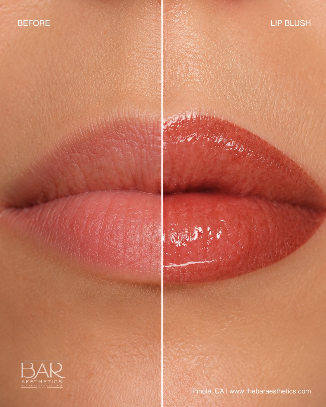 What does lip blush actually do?
✔ Enhances your natural lip color
✔ Defines the lip border
✔ Helps lips appear more symmetrical
✔ Neutralizes uneven tones
✔ Creates a healthy, youthful flush of color
Every treatment is customized to compliment your natural features. The goal is enhancement, not changing your lips.
Swipe to see more of the magic! 💋
📍Pinole, CA
#LipBlush #lipblushtattoo #PinoleCA #PMUArtist #BayAreaBeauty