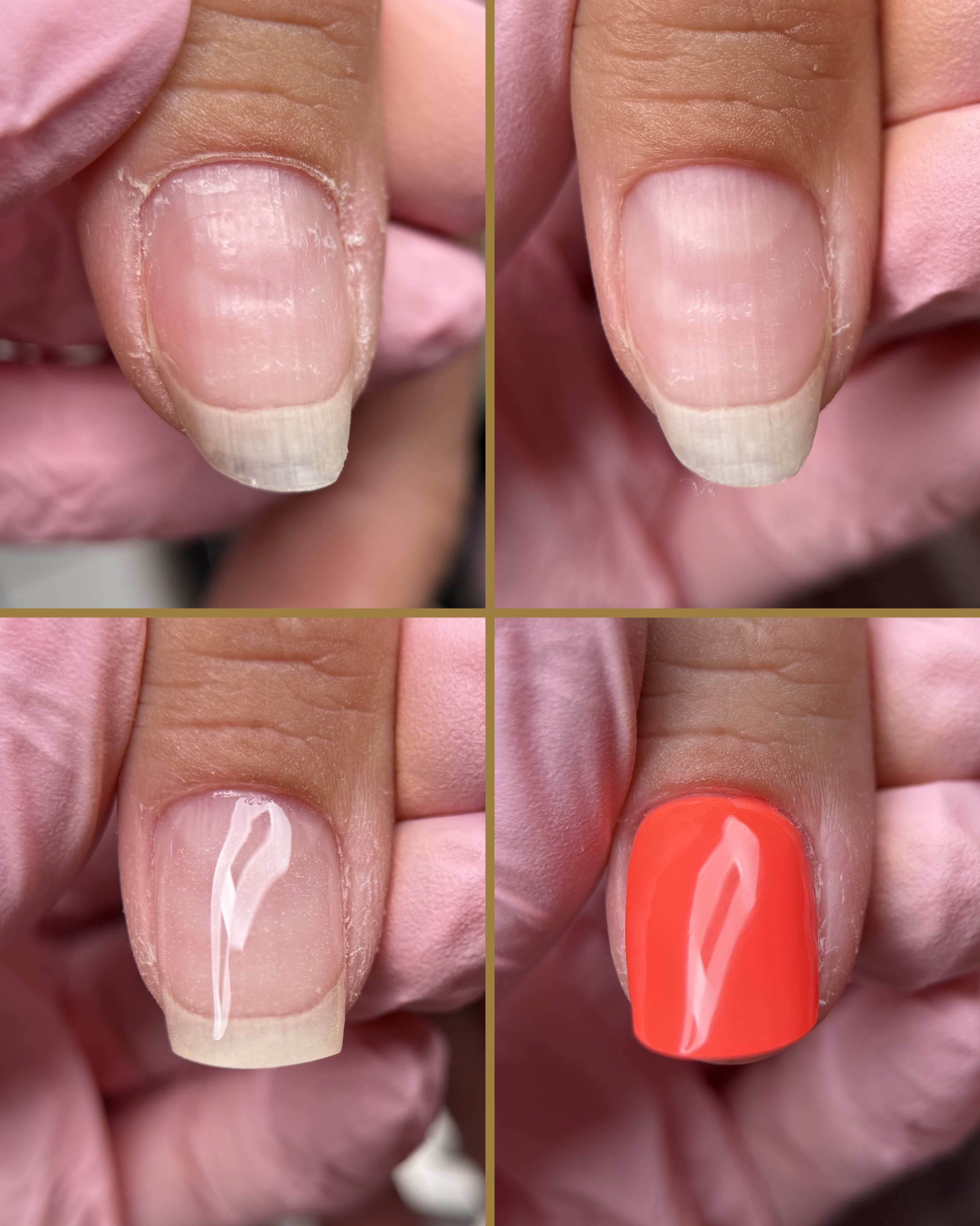 Elle m’a dit : « cet ongle est moche, je sais pas pourquoi il est comme ça. »
Moi je sais pourquoi il est comme ça, et je ne peux pas la laisser avec les irrégularités qu’il présente. Un vernis ne cacherait rien, et sa gêne resterait (sans parler du fait que ça ne tiendrait pas deux jours).
On a beau dire en rigolant « ça ne me gêne pas », toi et moi on sait que si, ça nous gêne.
Alors étape après étape, on a redonné une harmonie à son ongle, et rendu sa confiance à sa propriétaire.
« On dirait pas que c’est mon ongle à moi en fait ! T’avais raison, ça change tout ! »
Et toi, tu sais pourquoi il présente ces irrégularités ?
Ton avant n’a pas besoin d’être spectaculaire pour mériter une transformation. Il suffit qu’il te pèse.
Et si toi aussi tu veux ce résultat, écris-moi en DM.
——
Morane - prothésiste ongulaire
Beauté des mains et des pieds
Soin des ongles
Manucure & pédicure à Sancerre