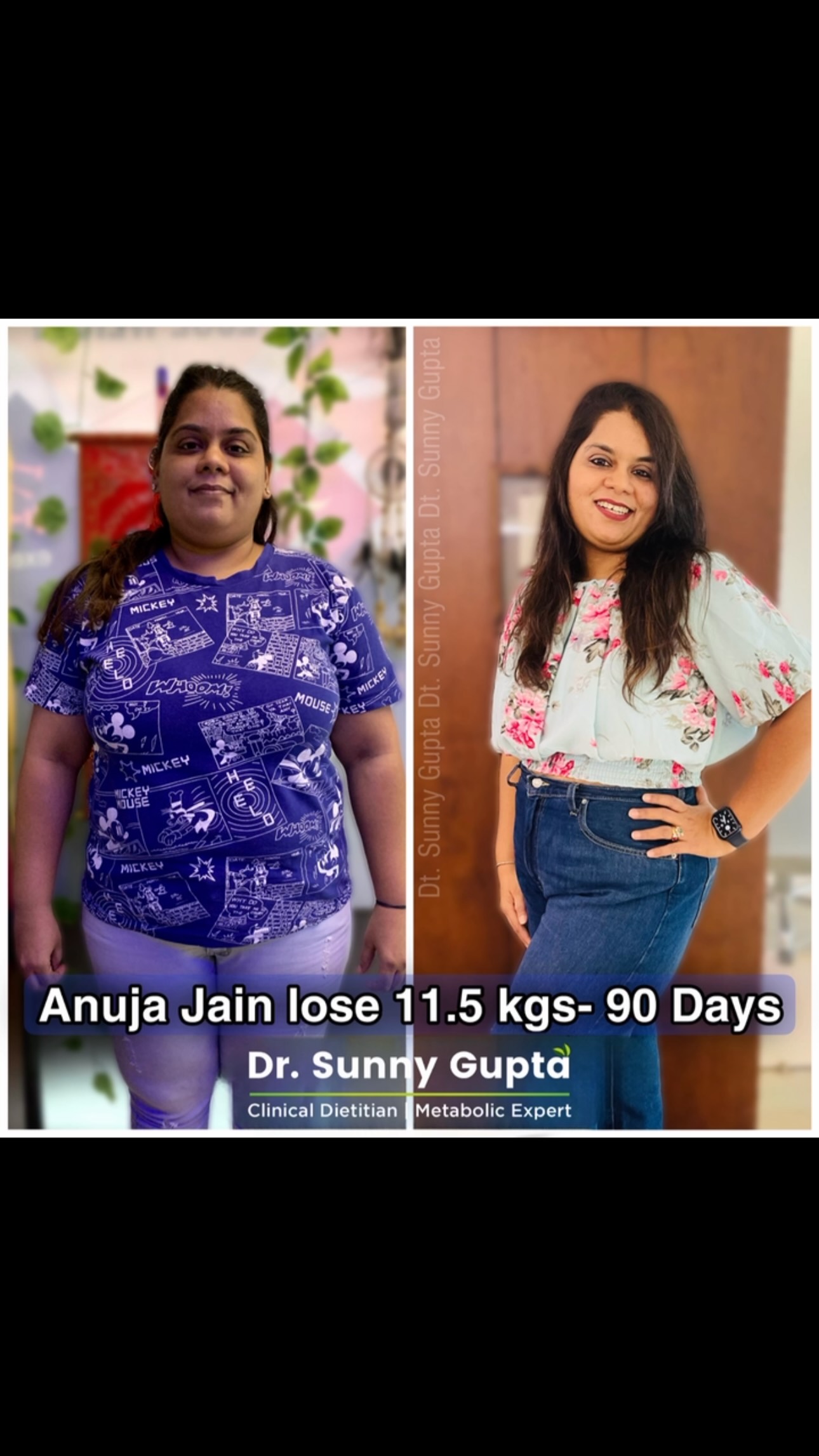 🌈 Meet Dr. Sunny Gupta
PhD | Clinical Dietician | Metabolic Health Coach
In a world where lifestyle disorders are rising rapidly, true health requires more than temporary diets and quick fixes. It requires understanding your body, your metabolism, and the habits that shape your future.
With 9+ years of clinical experience and guidance to 8000+ individuals across India and internationally, Dr. Sunny Gupta has helped people transform their health through science-based nutrition, metabolic correction, and sustainable lifestyle changes.
💚 What We Believe In
✔️ Personalized Nutrition – because every body responds differently
✔️ Metabolic Health First – the foundation of lasting wellness
✔️ Practical & Sustainable Eating Habits
✔️ Lifestyle Transformation over Temporary Dieting
✔️ Long-Term Results through Consistency and Education
🌱 Health is not about being perfect.
It’s about making better choices, understanding your body’s signals, and building habits that support you for life.
✨ Whether your goal is:
• Weight Management
• Better Digestion
• Improved Energy Levels
• Fatty Liver Support
• Metabolic Health Improvement
• Sustainable Fat Loss
Every transformation begins with awareness, guidance, and consistent action.
📲 Online Nutrition & Lifestyle Consultations Available
👉 www.drsunnygupta.in
👑 Your body is the only place you have to live for a lifetime. Invest in it wisely.
#drsunnygupta #dietitian #dietician #mrdetox #dtsunnygupta