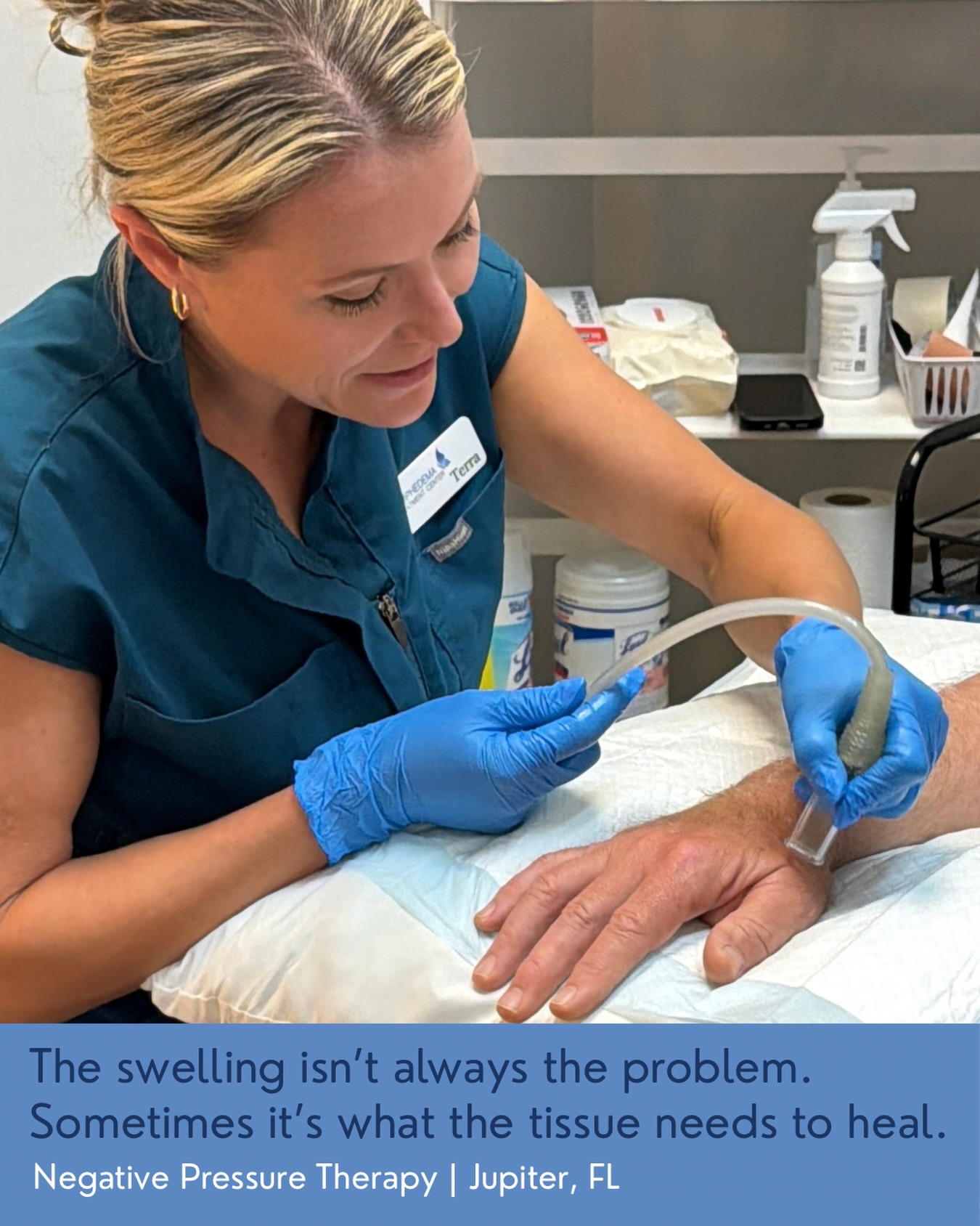 Still dealing with swelling, tightness, or an area that just doesn’t seem to heal properly?👇
Sometimes your body needs more than time, it needs the right support.
At Lymphedema Treatment Center in Jupiter, FL, we use Negative Pressure Therapy to gently lift and decompress tissue, helping improve circulation, encourage lymphatic flow, soften fibrosis, and support the body’s natural healing process.
This specialized therapy can be beneficial for:
💙 Chronic swelling and lymphedema
💙 Scar tissue and fibrosis
💙 Post-surgical recovery
💙 Areas of tissue tightness or congestion
Every treatment plan is personalized because healing isn’t one-size-fits-all.
We have customized treatment options to help you feel better sooner.
📍Lymphedema Treatment Center | Jupiter, FL
📲 Schedule a consultation to learn whether Negative Pressure Therapy may be right for you.
#NegativePressureTherapy #LymphedemaTreatment #SwellingRelief #LymphaticHealth #PostSurgicalRecovery