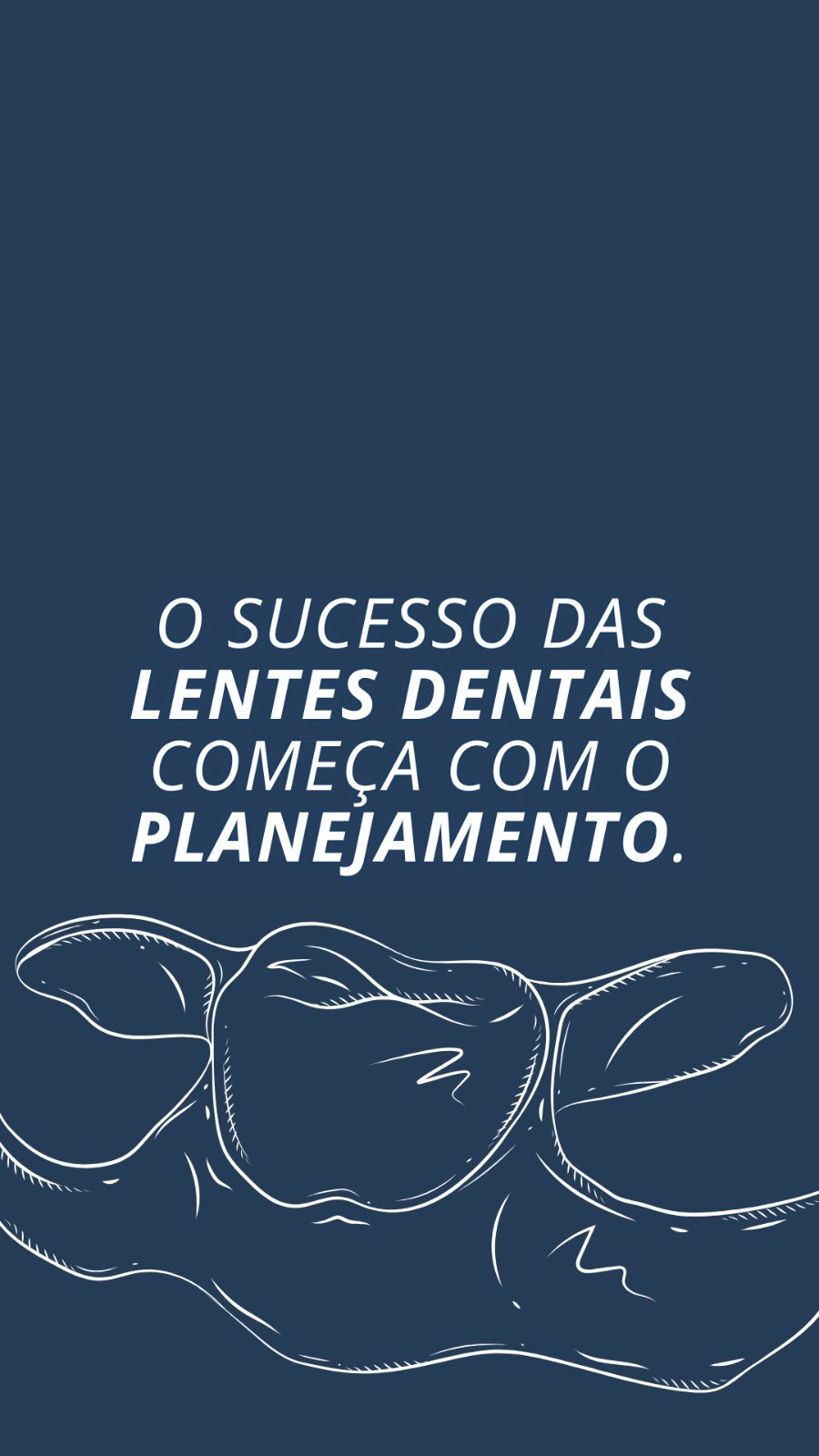 As lentes de contato dental podem transformar um sorriso. Mas o que realmente faz a diferença no resultado não é a lente em si: é o planejamento.
Antes de pensar em estética, é preciso avaliar a saúde da boca. Um dente com cárie, necessidade de tratamento de canal, problemas gengivais ou até alterações no posicionamento dos dentes pode precisar de outros tratamentos antes da colocação das lentes.
Cada sorriso tem uma história, uma estrutura e necessidades diferentes.
Por isso, o planejamento é o primeiro passo para alcançar um resultado bonito, natural e, principalmente, saudável. Afinal, estética de verdade começa com saúde. ✨🦷