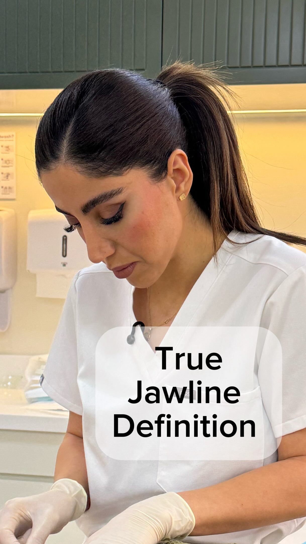 A defined jawline isn’t always about adding more volume❌
Before choosing any treatment, the first question should always be: What is actually causing the loss of definition?
🔺Sometimes it’s excess fat.
🔺Sometimes it’s lack of structural support.
🔺And sometimes, like in this case, the main issue is skin laxity.
If we don’t identify the real cause, we risk treating the symptom instead of the problem.
That’s why every treatment plan should start with a diagnosis—not a procedure✅
The goal isn’t to perform Endolift, filler, or any other treatment just because its a good treatment!!❌
The goal is to choose the right treatment for the right patient.
.
.
.
#jawline #jawlinefiller #endolift #endoliftdubai