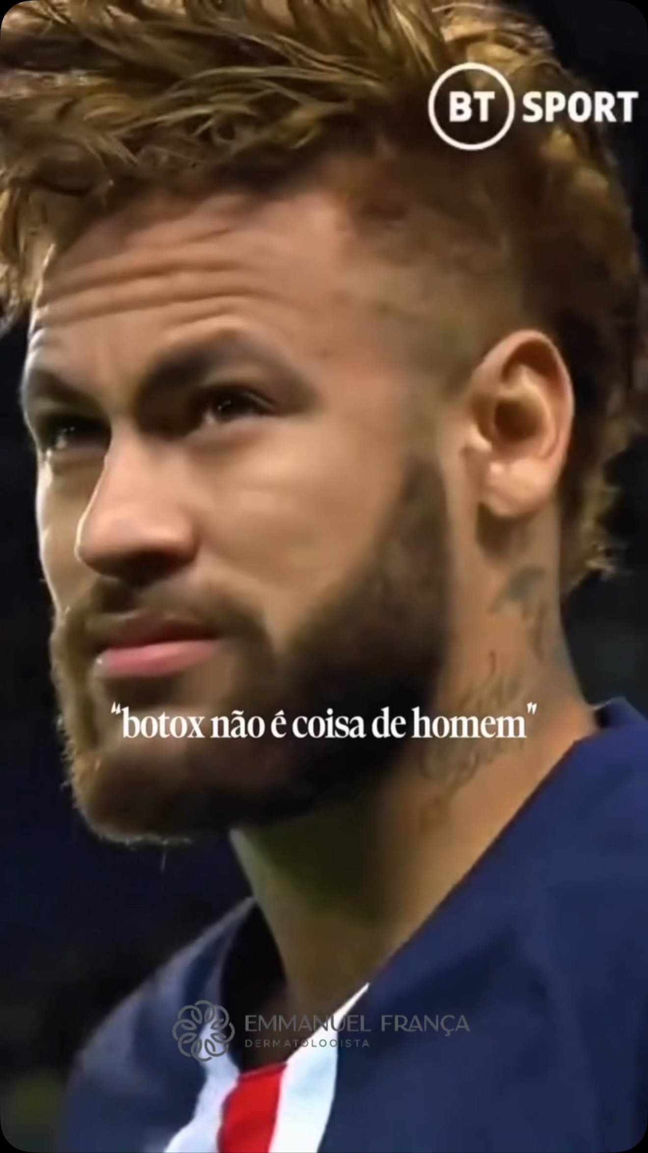 “Botox não é coisa de homem.”
É coisa de quem quer se sentir bem com a própria imagem.
A toxina botulínica não tem gênero. Ela é uma ferramenta da dermatologia que ajuda a suavizar linhas de expressão, preservar a naturalidade do rosto e proporcionar uma aparência mais descansada, sem mudar quem você é.
Cada vez mais homens têm entendido que cuidar da própria aparência não é vaidade excessiva, mas uma forma de investir na autoestima e na confiança. O importante não é seguir estereótipos, e sim fazer escolhas que façam sentido para você.
Dr Emmanuel França
Dermatologista
CRM 5999
RQE 636