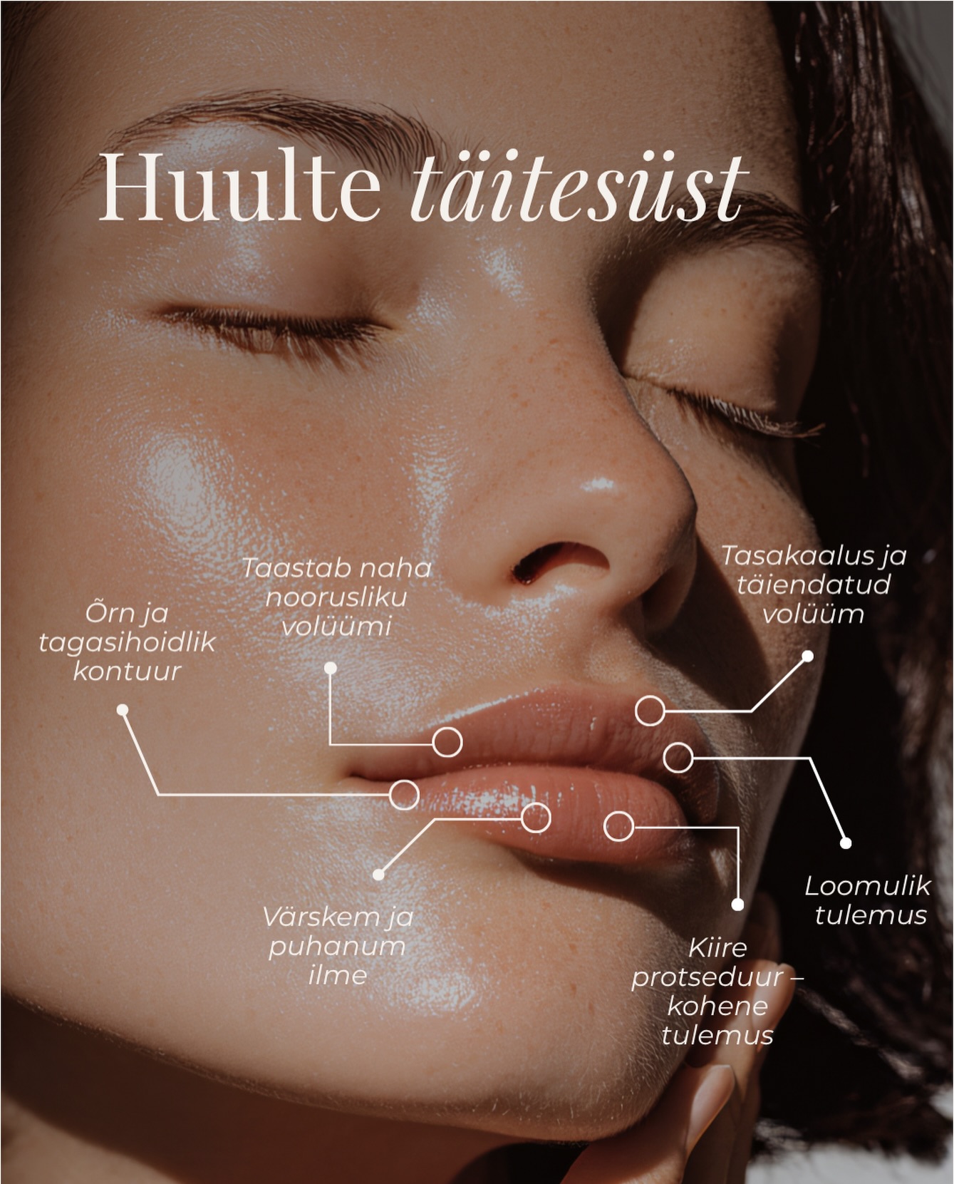 💋 Huulte täitesüst – rohkem kui lihtsalt volüüm
Kaunid huuled ei tähenda alati suuremaid huuli. Hästi teostatud huulte täitesüst aitab taastada loomulikud proportsioonid, rõhutada kontuuri ning lisada niisutust ja värskust.
Tulemuseks võivad olla:
õrnalt rõhutatud huulekontuur
tasakaalustatud ja loomulik volüüm
nooruslikum ning puhanum ilme
kohene efekt, mis areneb lõplikuks tulemuseks paari nädala jooksul
Medicina Kliinikus lähtume alati Sinu näojoontest ja soovidest – eesmärk on harmooniline ning loomulik tulemus, mis sobib just Sinule.
📍 Vastuvõtt Tartus
#huultetäitesüst #huultetäitesüstid #täitesüstid #esteetilinemeditsiin #medicinakliinik
