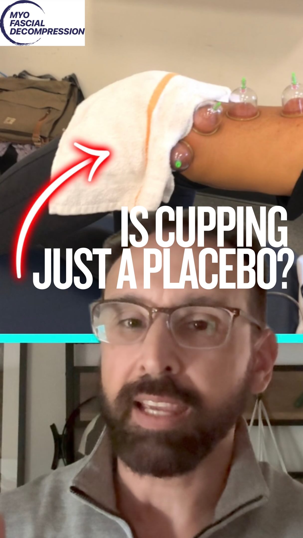 Here we are again, providing details of cupping research for you. 🤓 This one on the many “Sham” cupping studies out showing no differences in the effects when comparing 300-400 mmHg to… 100 mmHg as the control, and then call it all a placebo. 🤦🏽♂️
⭕️
Here’s the problem: the skin and dermis doesn’t wait for a high pressure to send signals to the 🧠 , you’re already stimulating low-threshold mechanoreceptors and cutaneous afferents in the dermis — at 100 mmHg. The nervous system doesn’t wait for a “clinically meaningful” pressure before it responds. It just feels pull and starts firing.
⭕️
Bottom line: cupping research does need better controls, not just smaller numbers. Otherwise we’re comparing “strong neuro stimulus” to “medium neuro stimulus” and calling one of them nothing.
Cupping is a neurological priming window. Dose matters. Sham doesn’t exist the way we pretend it does in many of these studies. Details matter, and we are here to bring the details and science when you are ready for it.
#recovery #mobility #beyondcupping #myofascialdecompression