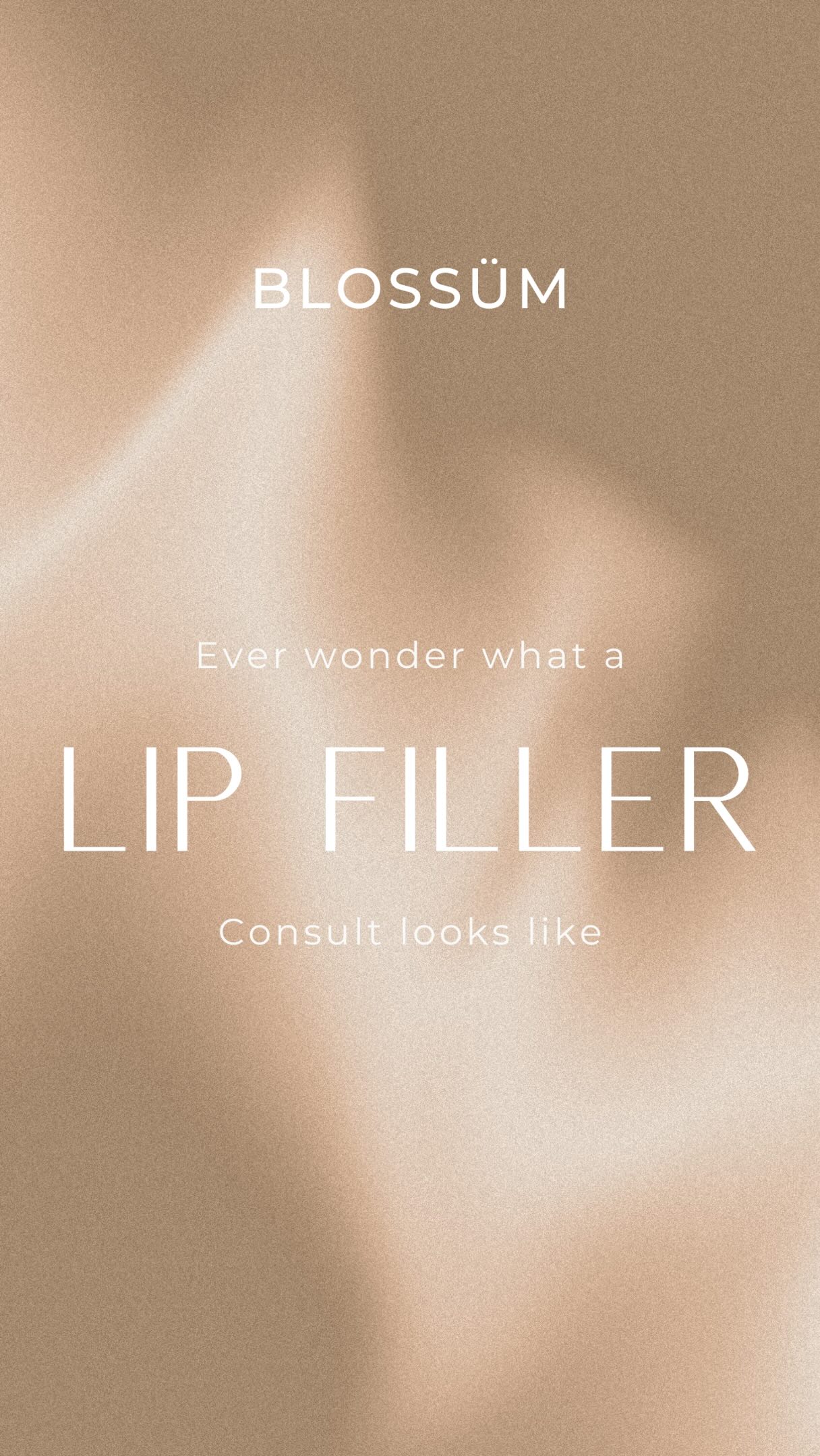 This is why I don’t get offended when patients pull up photos. I actually love it!
I know a lot of injectors don’t but it allows me to tell patients I’ll post her before, post dissolving, inspo picture and after. So I can know what you mean by “plump” most people don’t mean projection but that’s what it means to us. They’re usually talking about height. Sometimes they are talking about projection and they aren’t a good candidate for projection yet. So it allows us to talk through all of this and allows me to tell you what I expect to be possible and what may not be possible or possible yet.
I’ll be posting her before (where she was injected somewhere else), her post dissolving photo, her inspo and her final result!
#lipfillerraleigh #medsparaleigh #lipfillercharlotte