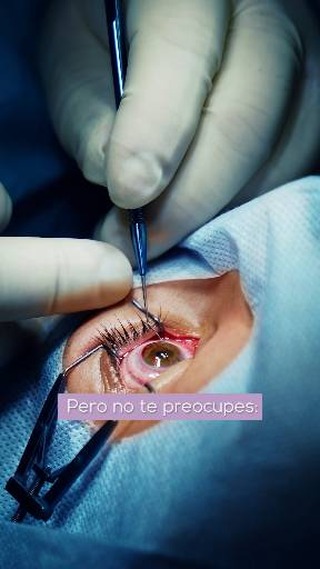 👓 Ver borroso no es "normal". Y hoy tiene solución.
Con cirugía láser (LASIK) corrijo tu graduación y mejora tu visión. No es igual para todos —por eso primero estudio tus ojos— pero para muchos es el día que lo cambia todo. Tu visión es tu calidad de vida 💜
👉 Escríbeme por DM y darte la asesoríaque necesitas