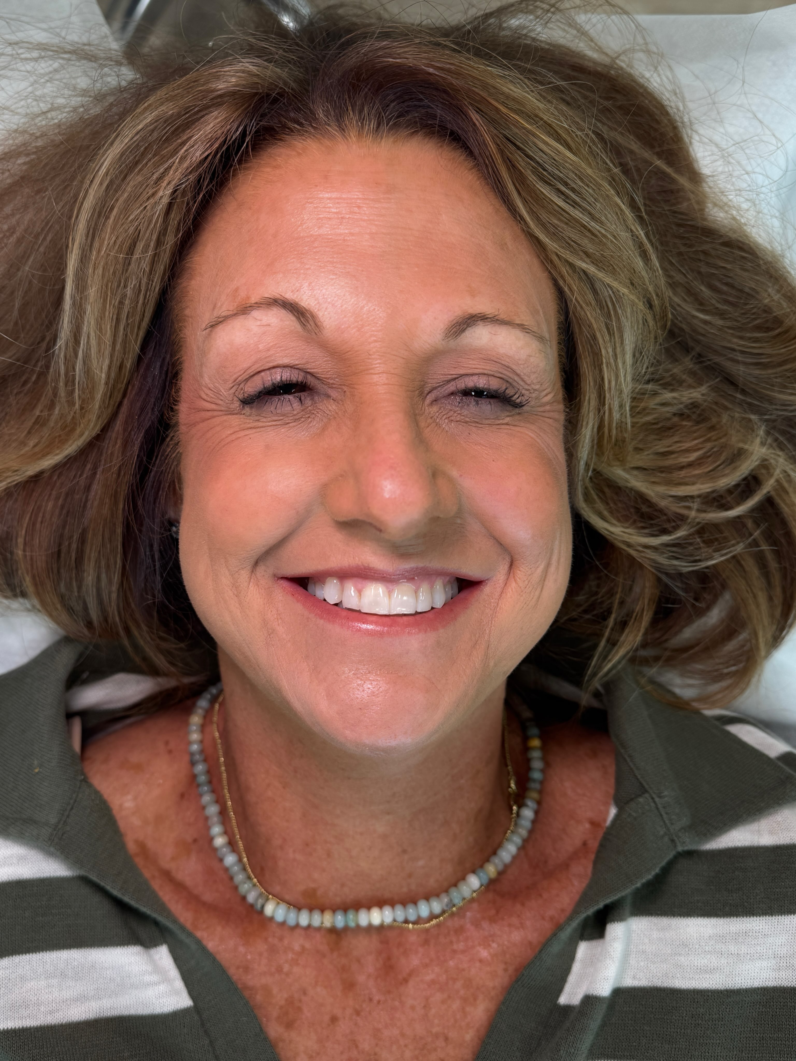 Can I call myself a Brow Restoration Specialist?
Sure, is making an already esthetic brow even prettier fun? Of course it is silly but restoring one that has been over tweezed for decades is so much more fulfilling to me. Seeing the balance it brings your face and the confidence it instantly gives 🤌🏼
I know you have reservations about brow tattoo and you should (I see more crappy work than I see good) BUT when you find the right artist that has the skill and experience to restore your brow in the most natural way - DO IT! You won’t regret it! That’s all! Have a great weekend y’all!