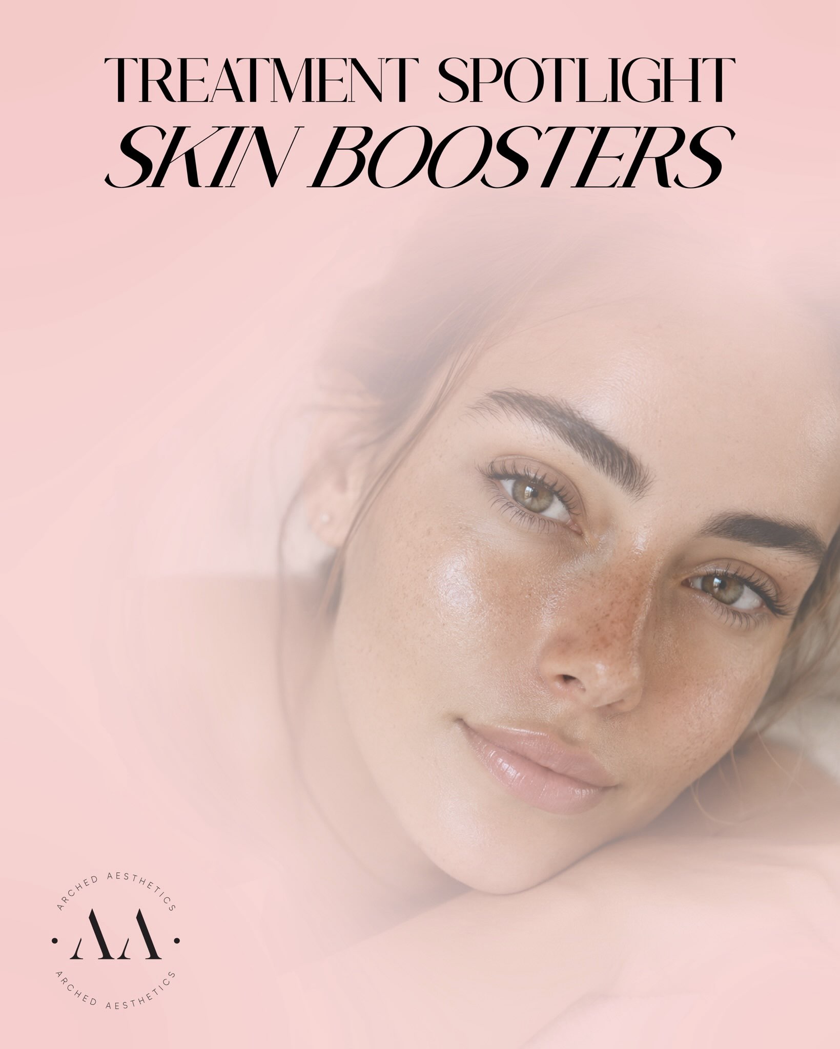 
✨ 𝗧𝗿𝗲𝗮𝘁𝗺𝗲𝗻𝘁 𝗦𝗽𝗼𝘁𝗹𝗶𝗴𝗵𝘁: 𝘚𝘬𝘪𝘯 𝘉𝘰𝘰𝘴𝘵𝘦𝘳𝘴 ✨
If your skin feels dull, dehydrated, tired or lacking that healthy glow, skin boosters could be exactly what it’s been missing.
Unlike dermal fillers, skin boosters don’t add volume. Instead, they work beneath the skin to deeply hydrate, stimulate collagen and elastin production, and improve overall skin quality from within.
𝗔𝘁 𝗔𝗿𝗰𝗵𝗲𝗱 𝗔𝗲𝘀𝘁𝗵𝗲𝘁𝗶𝗰𝘀, 𝘄𝗲 𝗼𝗳𝗳𝗲𝗿:
💧 𝗣𝗿𝗼𝗳𝗵𝗶𝗹𝗼 – the gold standard for skin remodelling and deep hydration.
💧 𝗦𝗲𝘃𝗲𝗻𝘁𝘆 𝗛𝘆𝗮𝗹 – an intensely hydrating skin booster designed to improve glow, texture and skin laxity.
𝗦𝗸𝗶𝗻 𝗯𝗼𝗼𝘀𝘁𝗲𝗿𝘀 𝗮𝗿𝗲 𝗽𝗲𝗿𝗳𝗲𝗰𝘁 𝗳𝗼𝗿 𝗮𝗻𝘆𝗼𝗻𝗲 𝘄𝗮𝗻𝘁𝗶𝗻𝗴:
• Brighter, healthier-looking skin
• Improved hydration
• Smoother texture
• Increased elasticity
• A natural, refreshed appearance
These treatments are ideal on their own or combined with other aesthetic treatments as part of a personalised skin health plan.
__________________________
Thinking about aesthetic treatments?
Book your FREE consultation today 💫
📲 07517416782
📧 hello@archedaesthetics.co.uk
🌐 www.archedaesthetics.co.uk
⭐ 5 Star reviews
🎁 Gift voucher available
DM to book