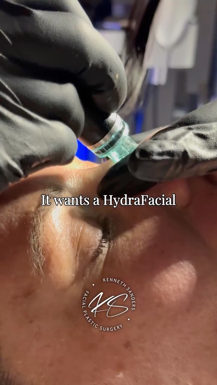 Summer is hard on your skin, but this is the perfect time to give it the hydration, exfoliation, and glow it's been asking for.
July 20-24 only:
✨ Book a Deluxe HydraFacial
✨ Receive a FREE upgrade to our Platinum HydraFacial
✨ Get FREE dermaplaning
✨ Enjoy 10% off ZO Skin Health and SkinMedica SPF
That's $355 worth of skincare for just $230.
Appointments are limited, so don't wait to reserve your spot. Call (318) 698-8711 to schedule your Summer Refresh Week treatment! ☀️💙
#HydraFacial #HealthySkin #MedicalSpa #ShreveportMedSpa #SummerGlow
