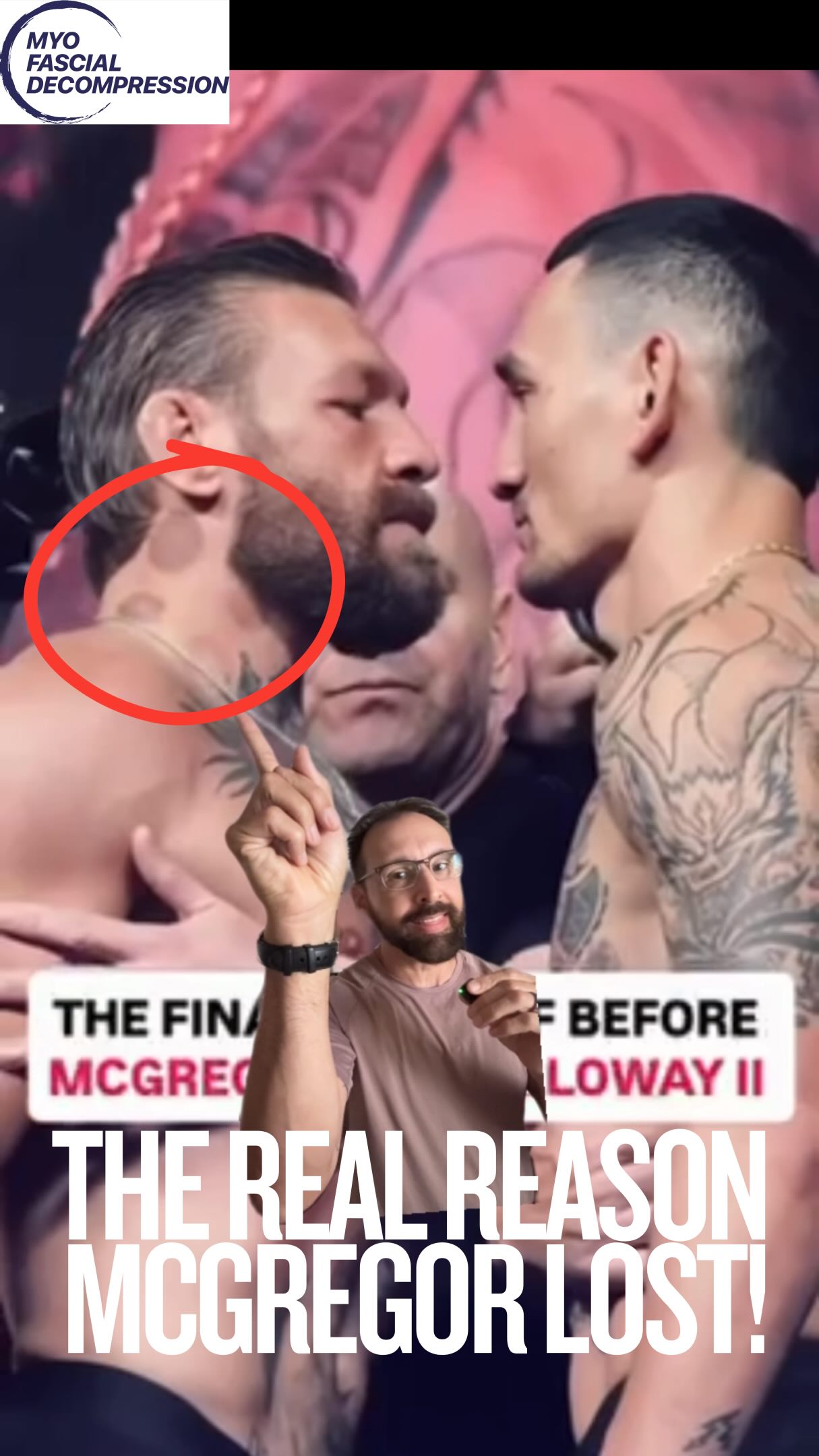 🚨 CONSPIRACY CORNER 🚨 What if Conor McGregor’s UFC 329 loss wasn’t a leg injury at all… but a rogue cupper hit the carotid sinus a day before and nobody wants to admit it? The balance and proprioception are jacked here! (He obviously had a leg issue, we know, we know — but let a cupping page have its fun.) 🤩 😅 Yes, if u haven’t figured it out yet, this is satire… kinda.
⭕️
Real talk though: never, ever leave static suction on the anterior triangle of the neck — carotid artery, jugular vein, baroreceptors are not to be toyed with. Know your pressure and know that you should be using a glide technique over this region, not leaving it there to create chaos on your vagus nerve.
Pressure gauge pump is a must have to be objective with cupping therapy and not just guessing! #mfdprecisionpump
#whatthecup #mcgregor #connormcgregor #beyondcupping