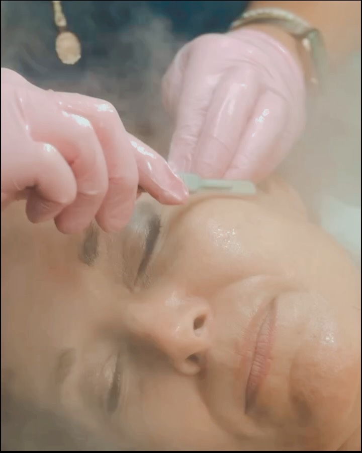 Getting party-ready starts with healthy skin. A little dermaplaning before Taylor’s birthday celebration made all the difference!
If you’ve never tried it, dermaplaning is a gentle treatment that uses a sterile blade to remove dead skin cells and fine facial hair (often called “peach fuzz”). The result? Smoother, brighter skin, better skincare absorption, and makeup that goes on beautifully.
It’s one of my favorite ways to refresh my skin before a special event and I always leave @theskingroup with that healthy glow.
Have you ever tried Dermaplaning?
#theskingroup #skincare #dermaplaning #glowup