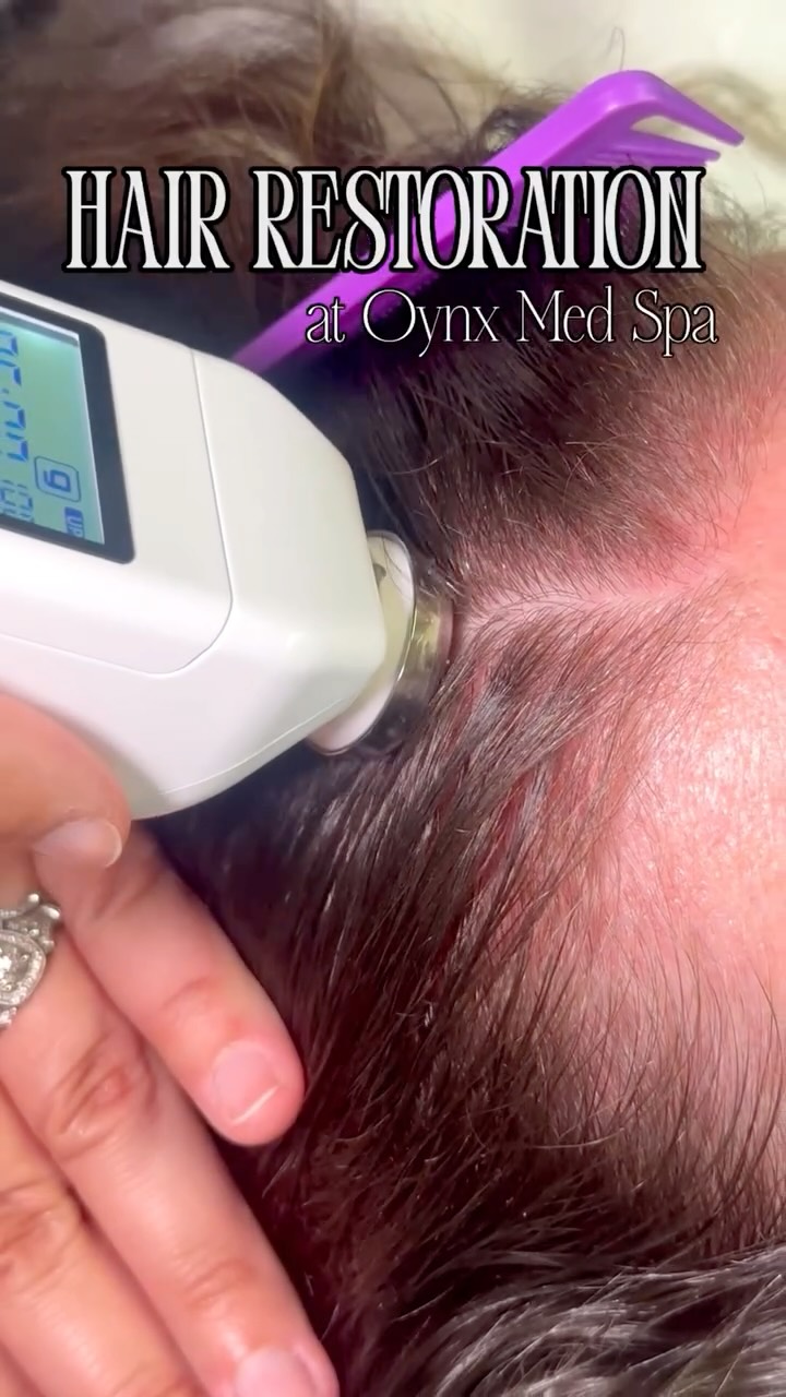 Beautiful hair begins with a healthy scalp.🤌🏻
Aging, hormonal changes, stress, postpartum, genetics, or even rapid weight loss can cause hair thinning. No matter what’s behind the change, you deserve solutions that are both effective and personalized.
Our AquaFirme Hair Restoration treatment is designed to nourish the scalp, support healthier, fuller-looking hair, and help restore your confidence with advanced, non-invasive technology.🤩
Because feeling like your best self isn’t just about your skin, it’s about confidence from head to toe.
Schedule your consultation today and discover a customized approach to healthier hair.
#hairrestoration #hairhealth #medspa #selfcare