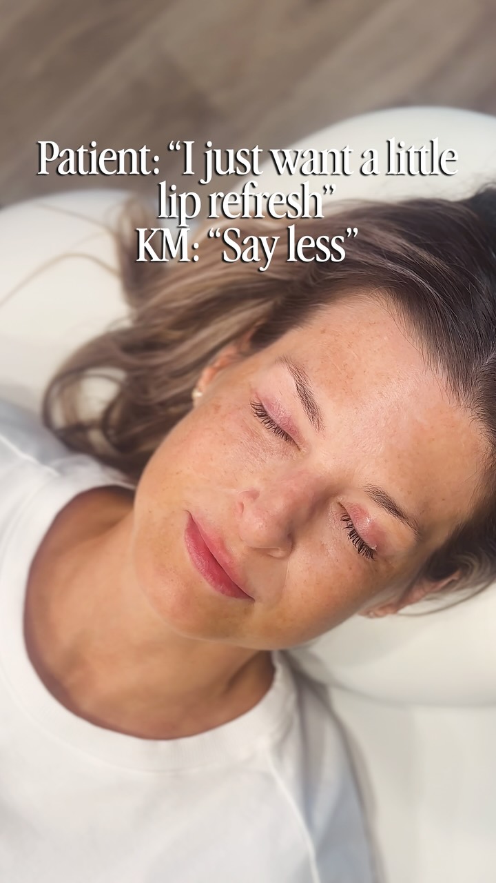 That Kristen Murphy Kiss 💋💉
The power of subtly is so prevalent in lip filler treatments. Kristen is all about getting you to that “wow, you are so glowy and refreshed” look 🤩
Are you ready for lip filler you’ll love? Call our office to schedule with Kristen Murphy, PA-C today 🗓️✨📱
#lipfiller #winstonsalem